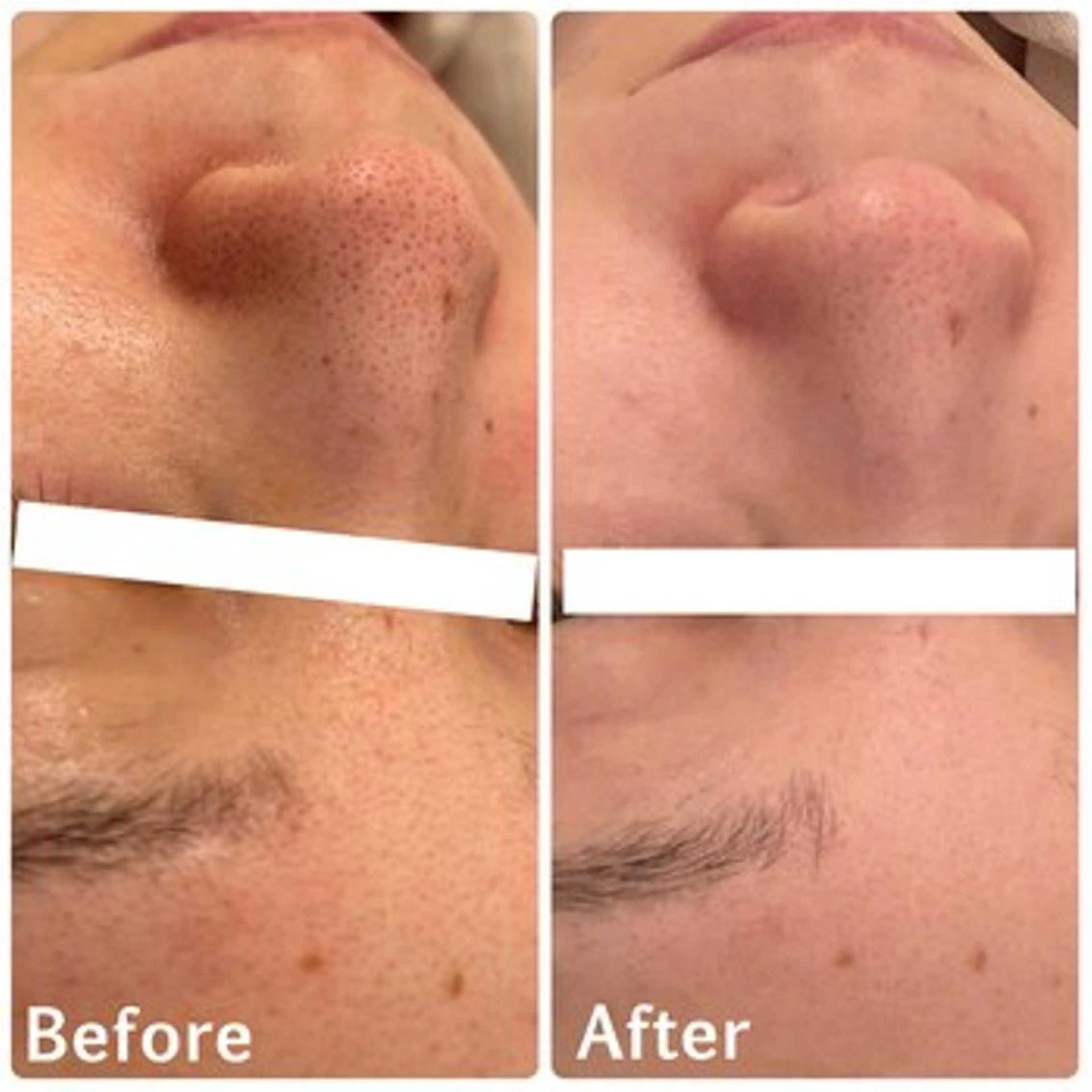 ララ/ハーブ メゾンリュバンのエステ・リラクイメージ