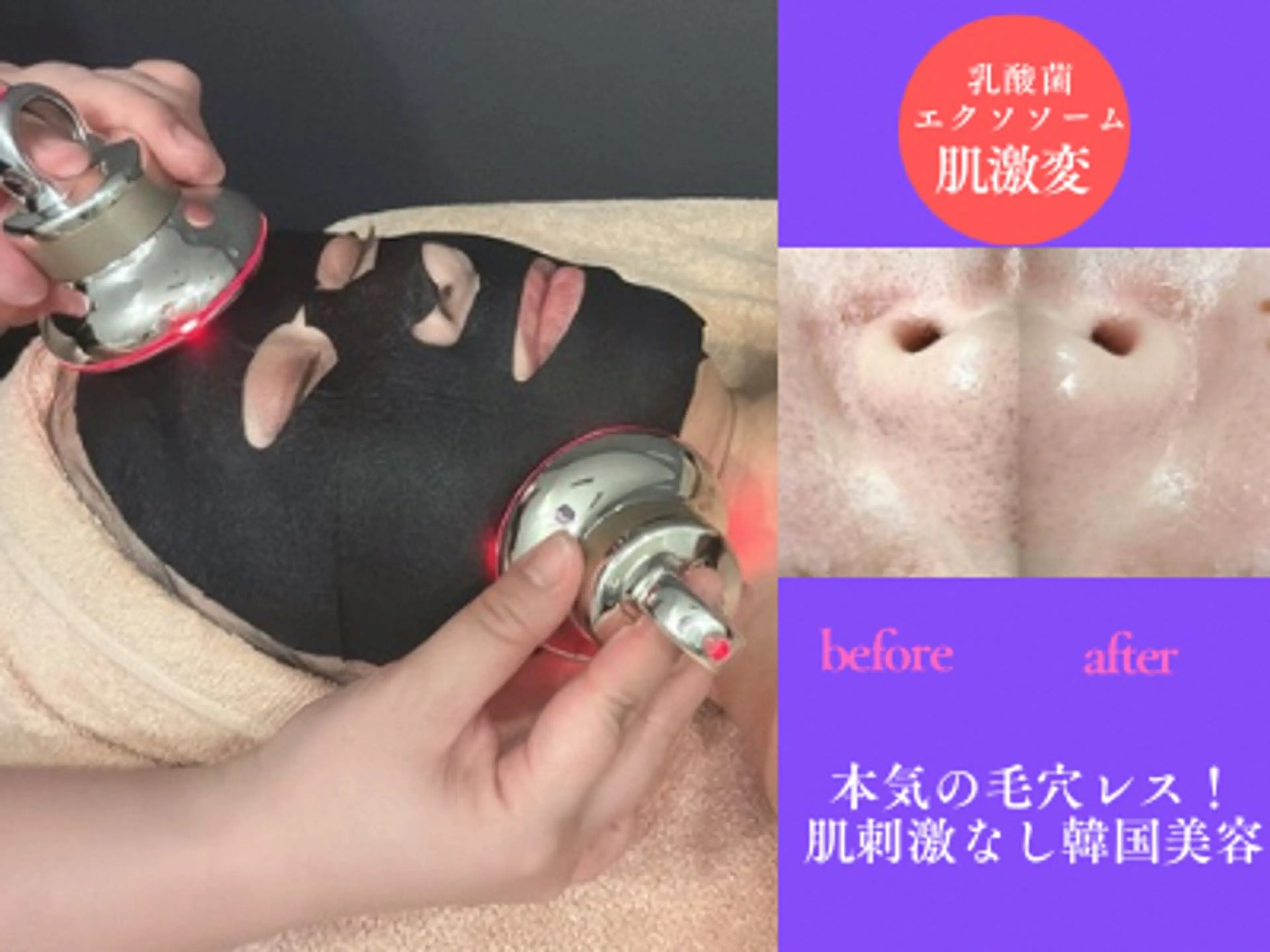 毛穴レス*うるツヤ肌*韓国エステで透明肌フェイシャル50分¥8,800→¥4,400の写真