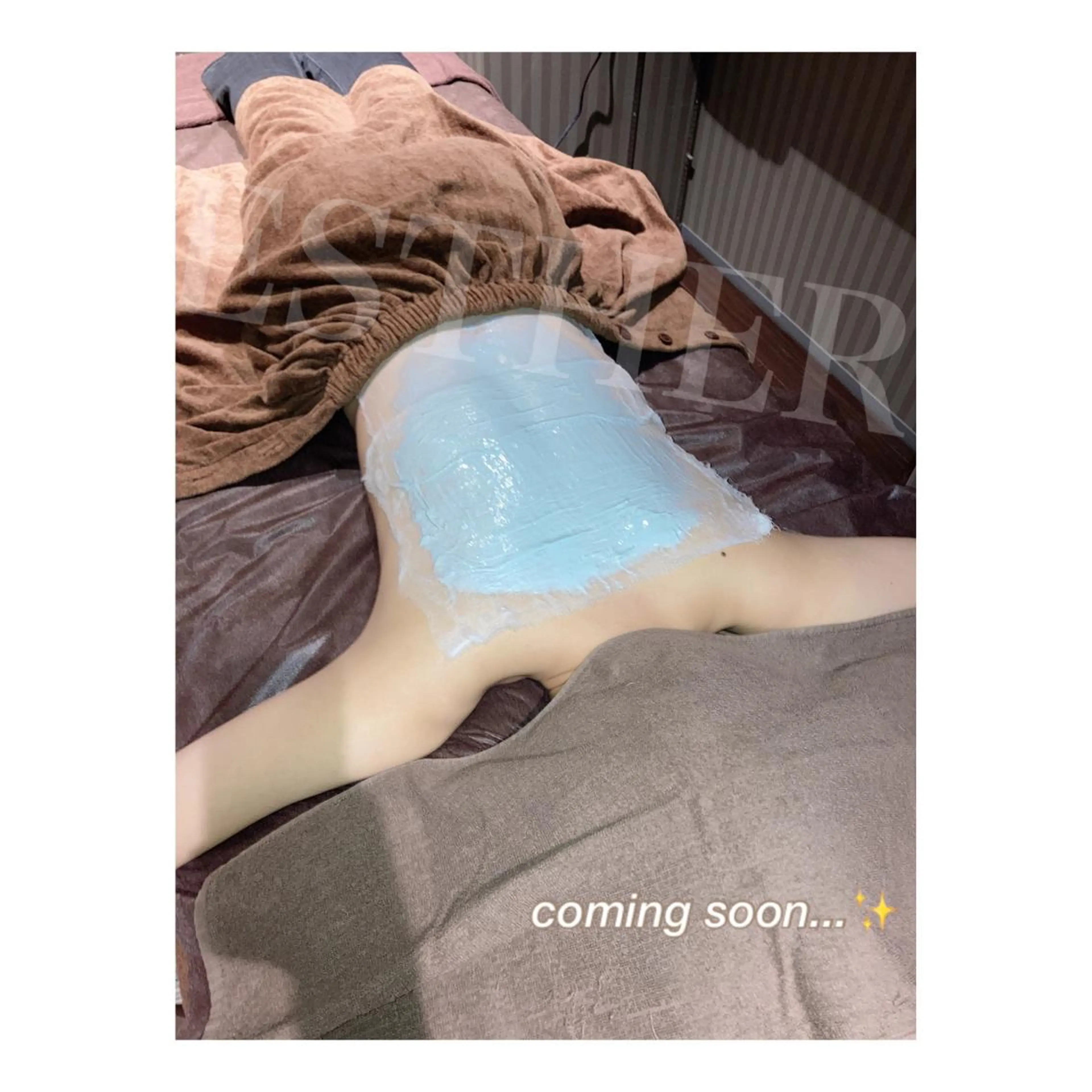 【ハーブピーリング🌿】すべすべ滑らかな背中へ✨繰り返しやすい背中ニキビ/ニキビ跡/毛穴の開き/色素沈着に⭕️の写真