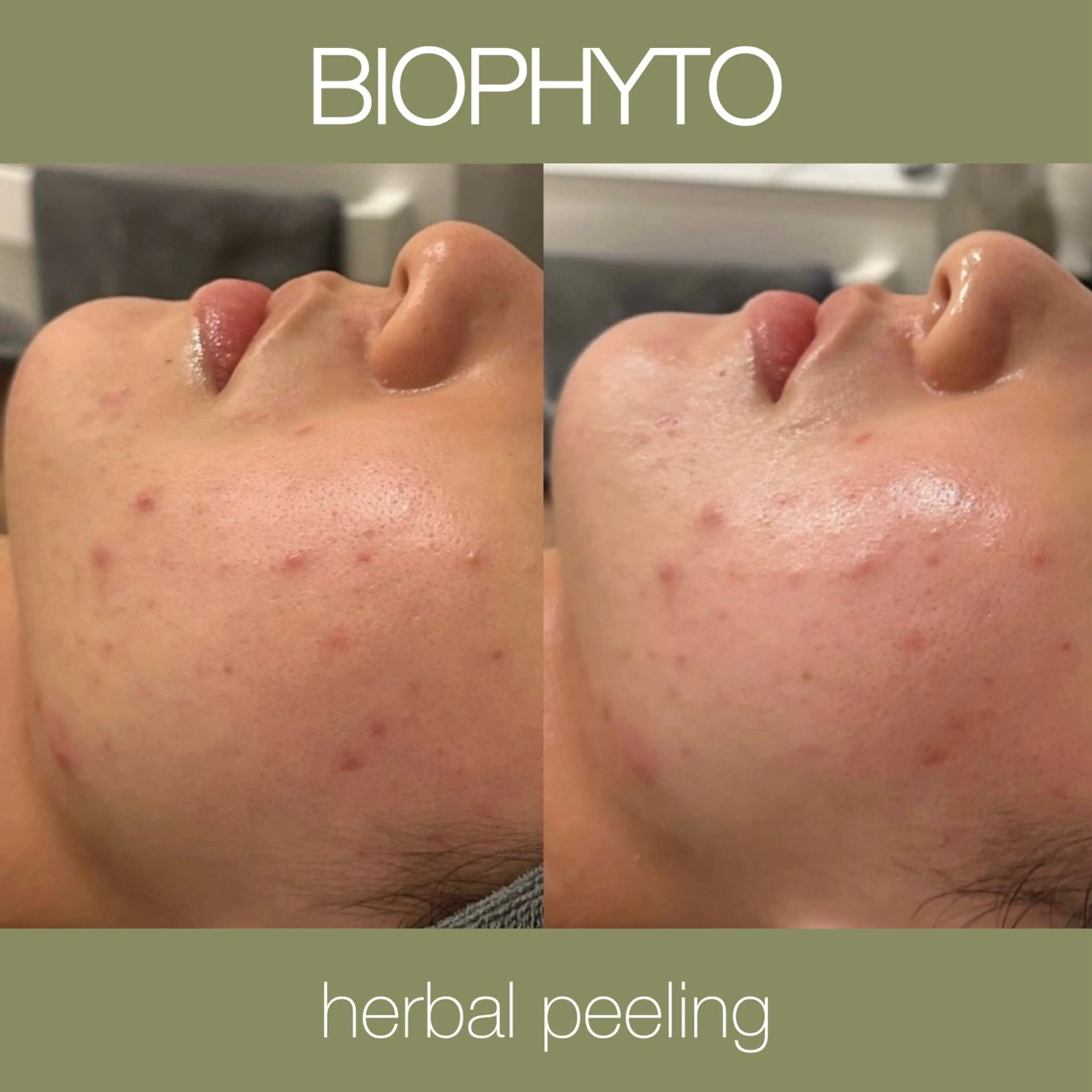 小顔コルギ ☆表参道/外苑前のエステ・リラクイメージ