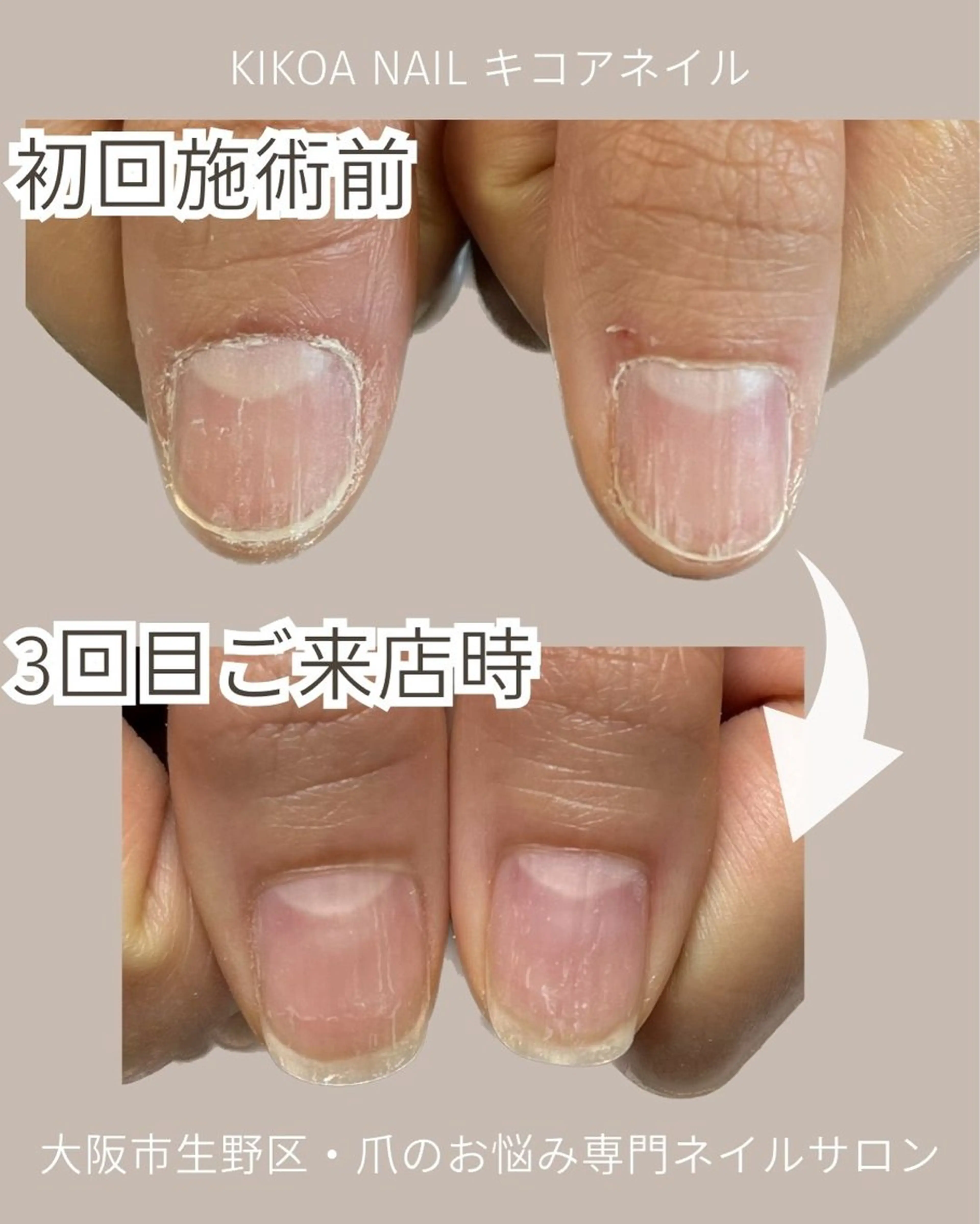 ネイル KIKOA NAIL キコアネイルのネイルデザイン