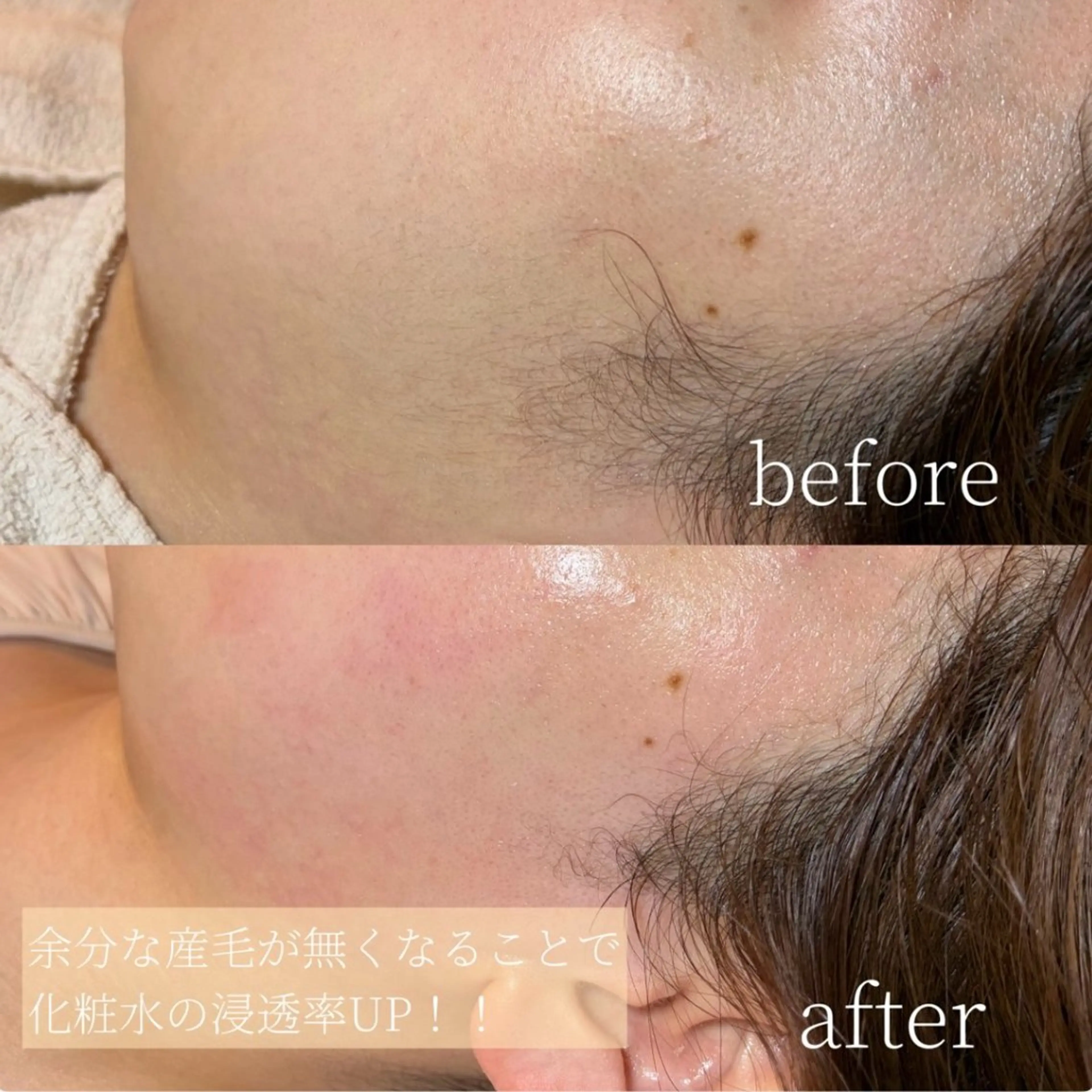 Erika komorebi_のエステ・リラクイメージ