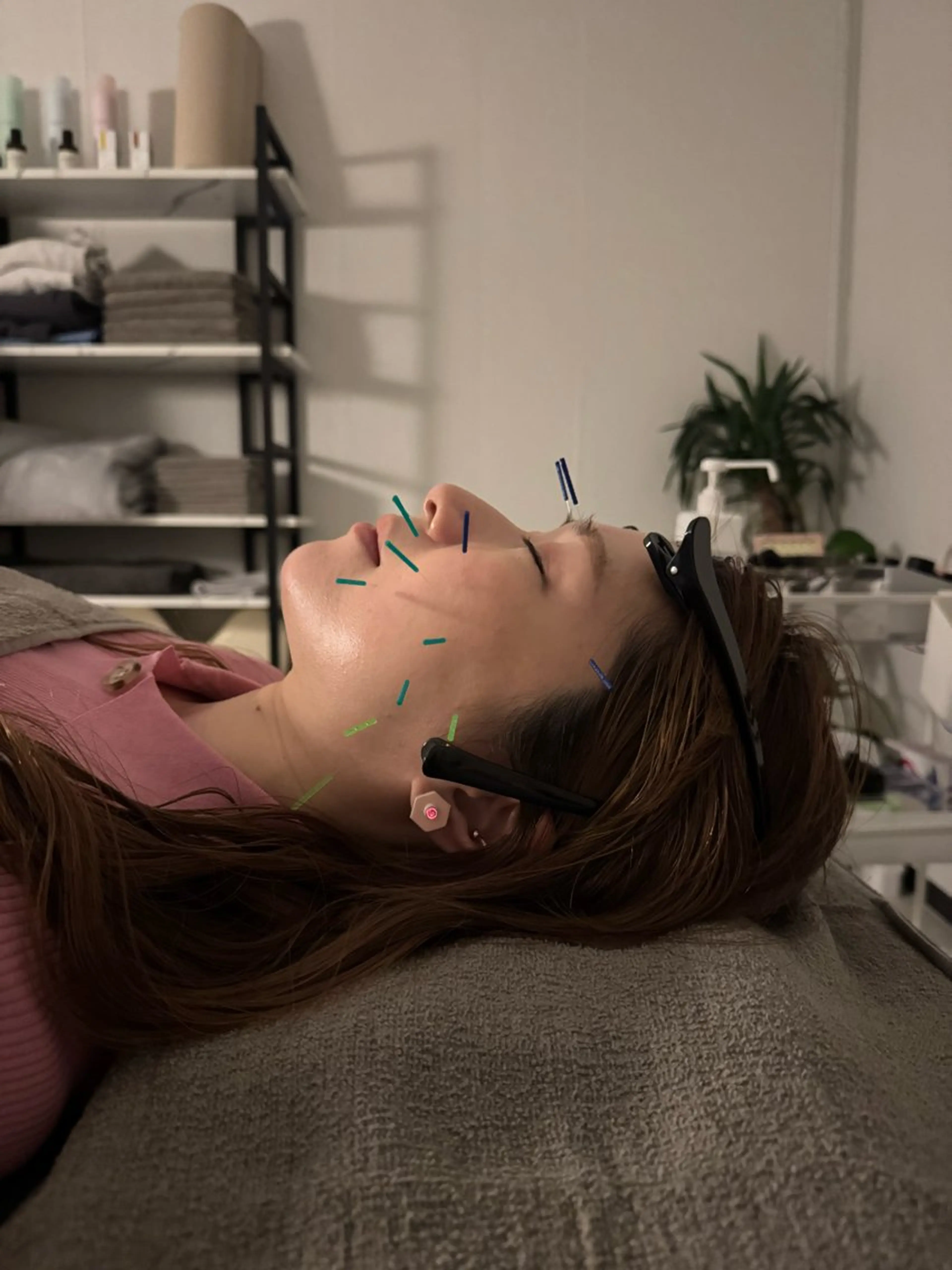 エステ 美容鍼×小顔矯正 ×美容整体　浜川泰仁のエステ・リラクイメージ