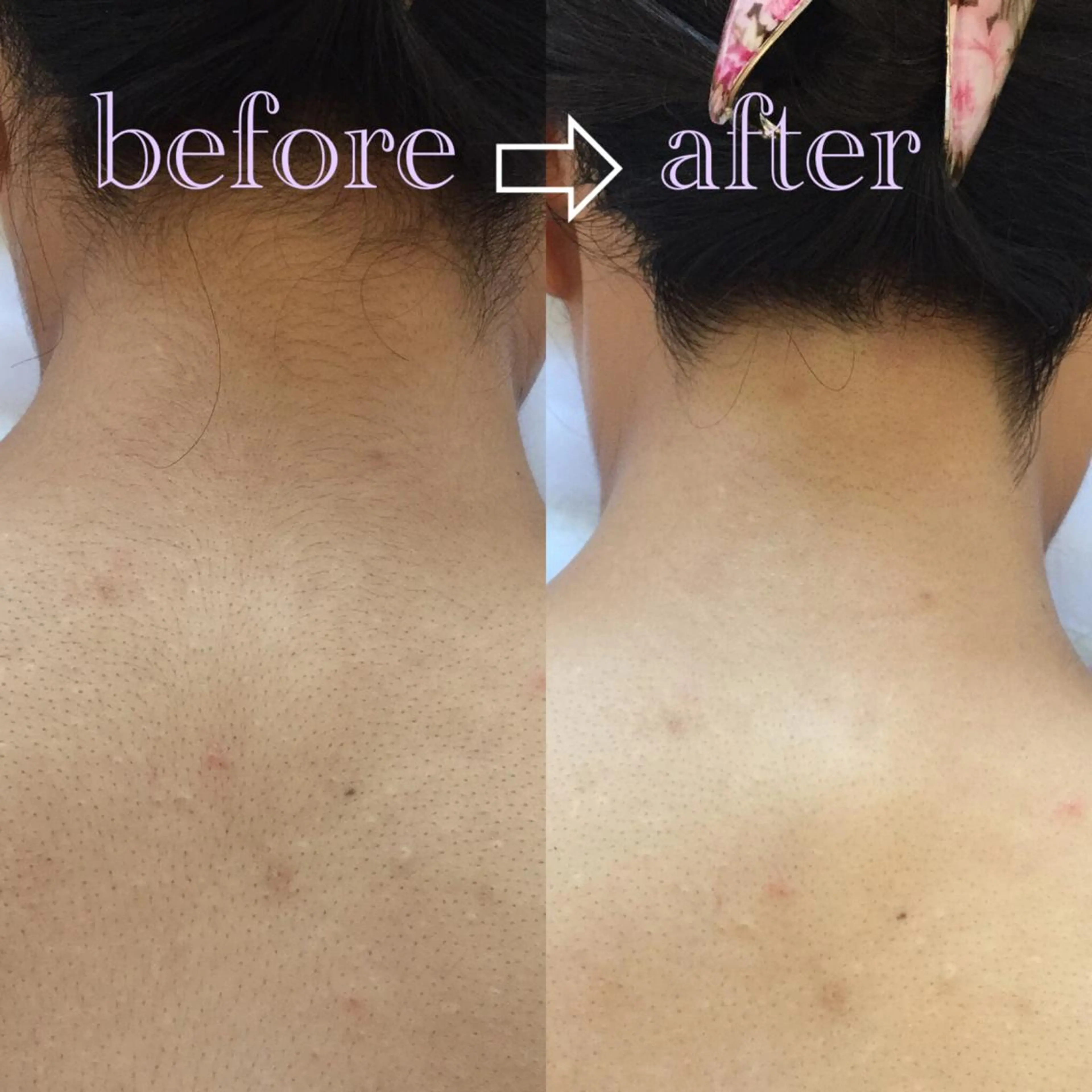 フェミニンエステ ティック大阪福島店のエステ・リラクイメージ