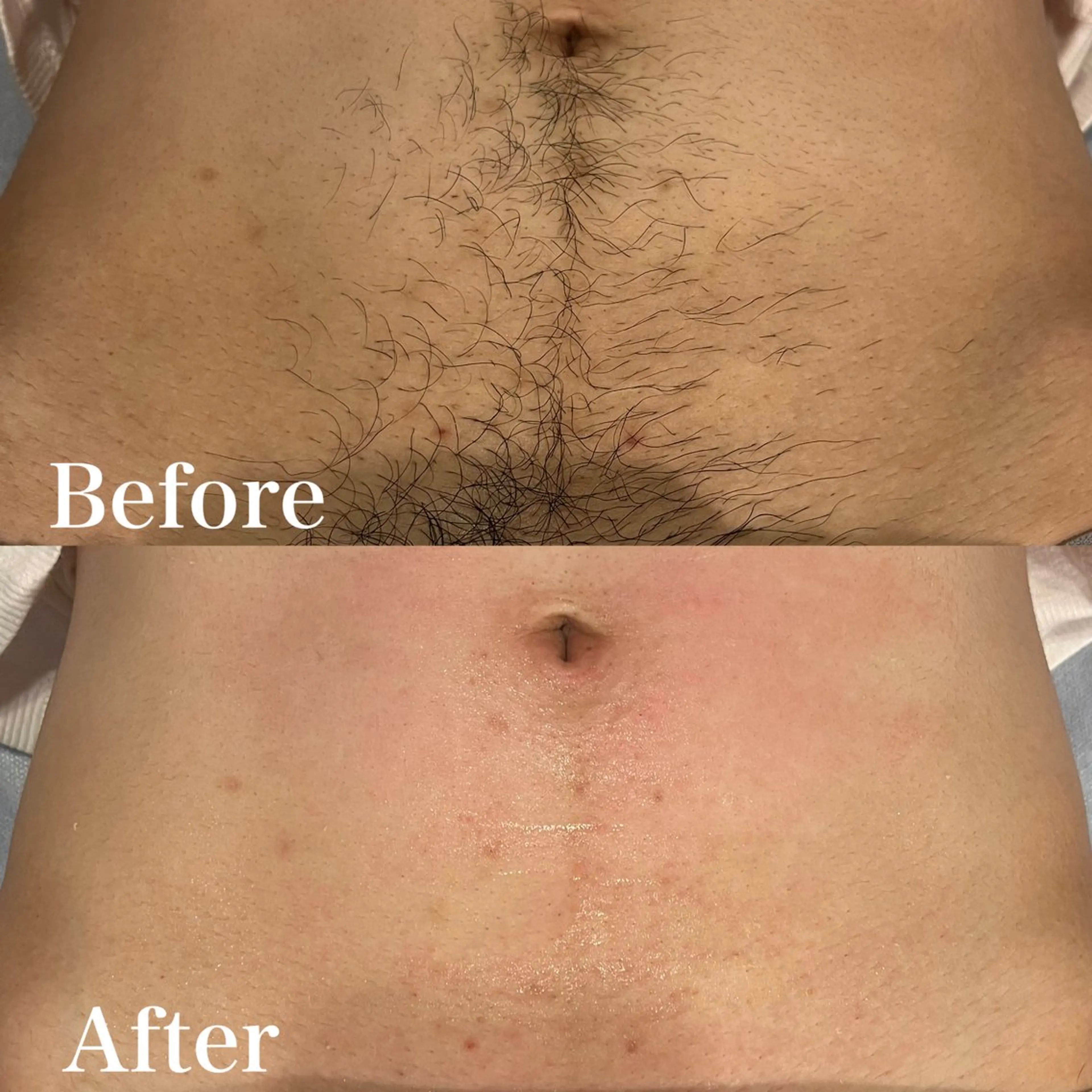 メンズ 脱毛 wax脱毛専門店 ハイラントのエステ・リラクイメージ