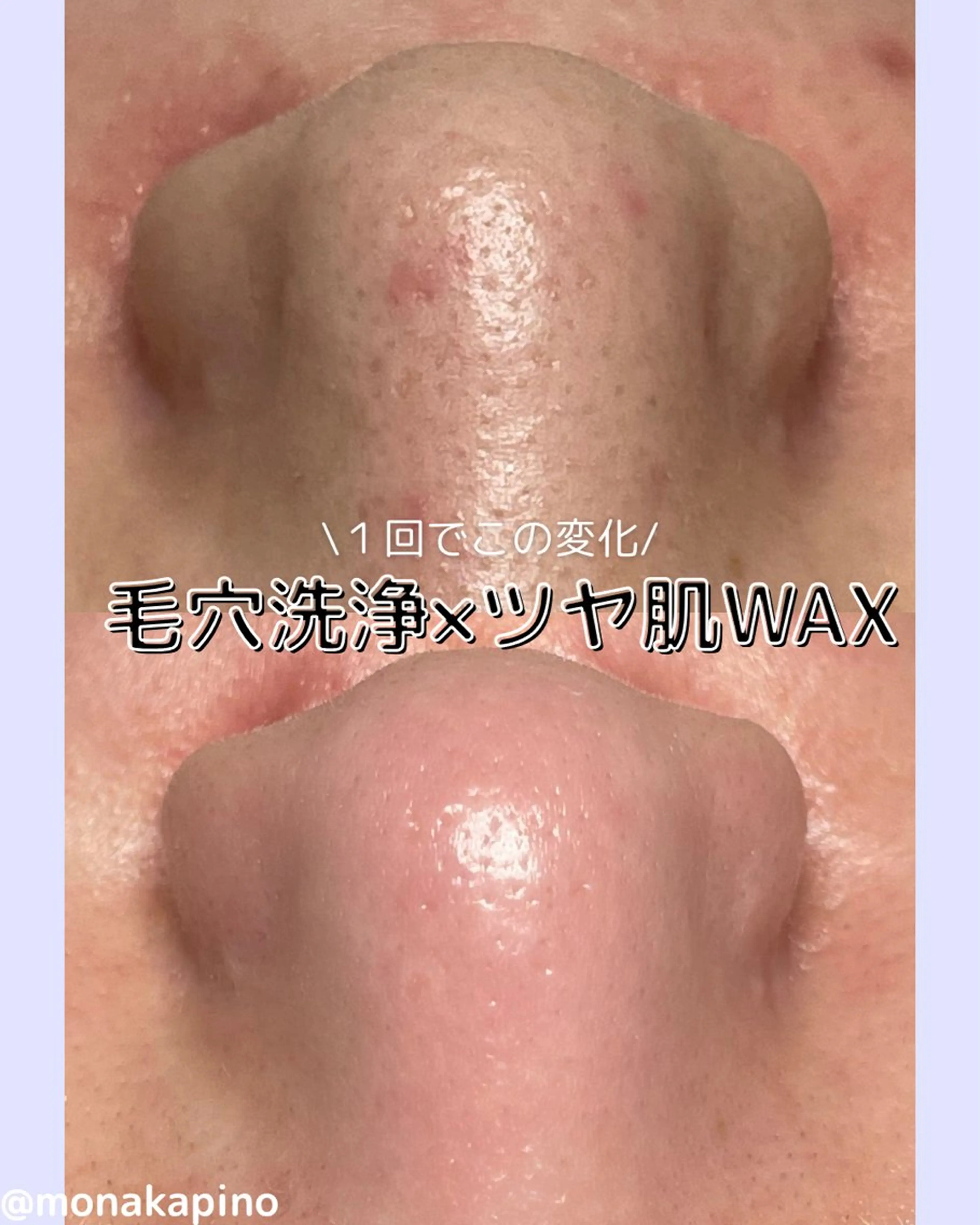 鼻の毛穴にお悩みの方💭毛穴洗浄×ツヤ肌WAX【鼻のみ】✨の写真