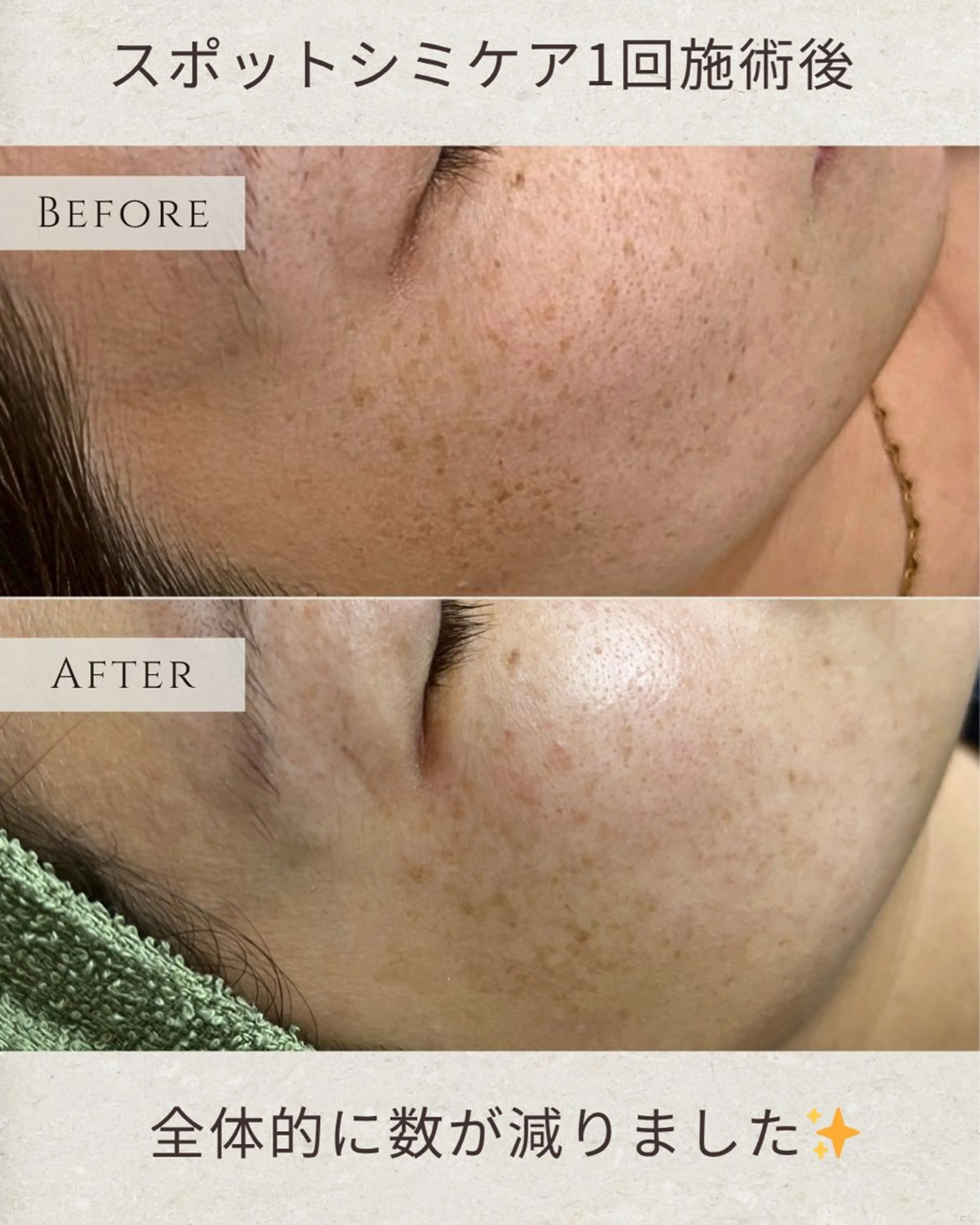 稲垣 優のエステ・リラクイメージ