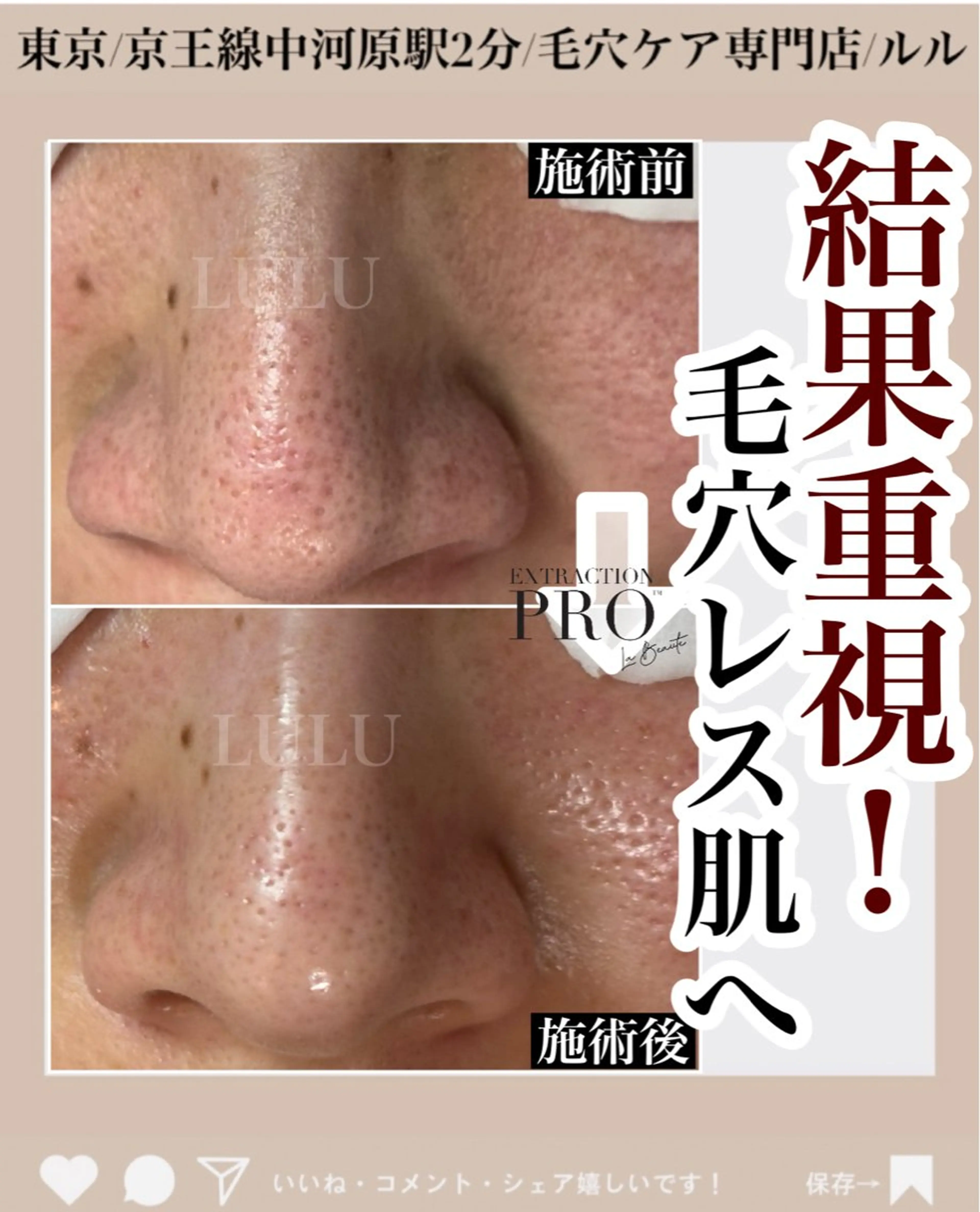 エステ LULU ルルのエステ・リラクイメージ