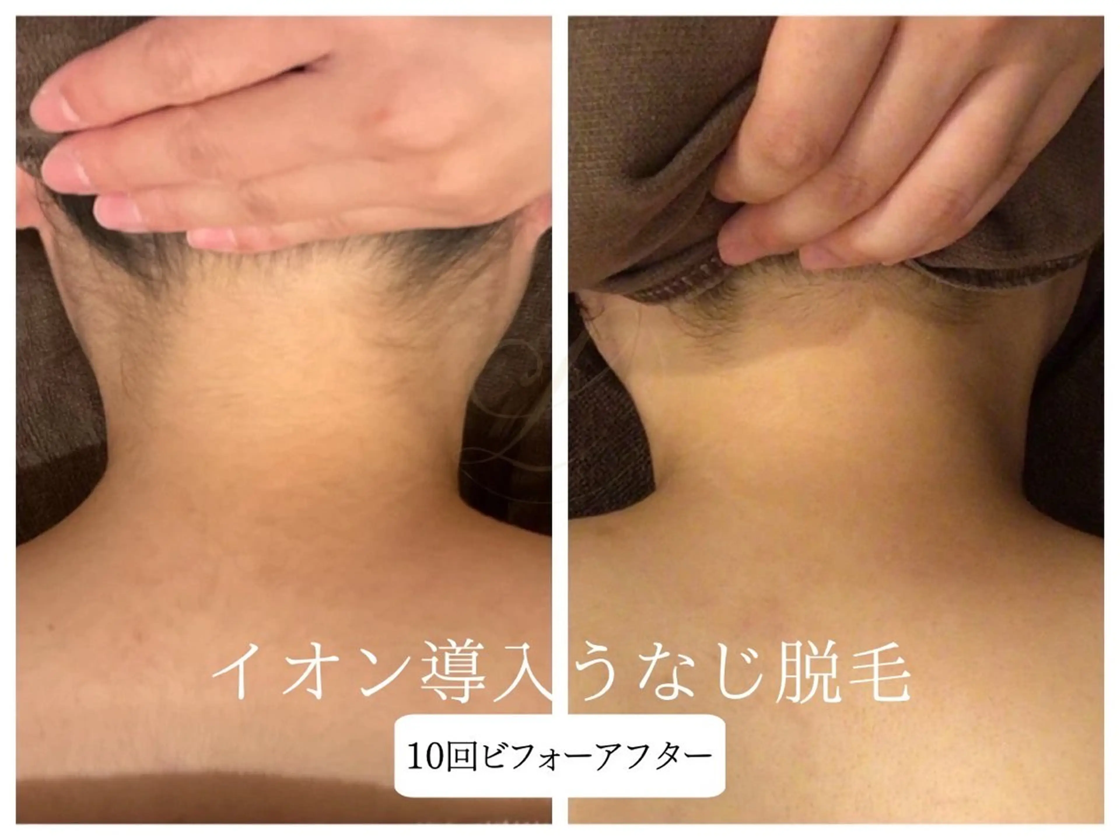 脱毛 🎀うなじ脱毛🎀 ㅣLino堀江のエステ・リラクイメージ