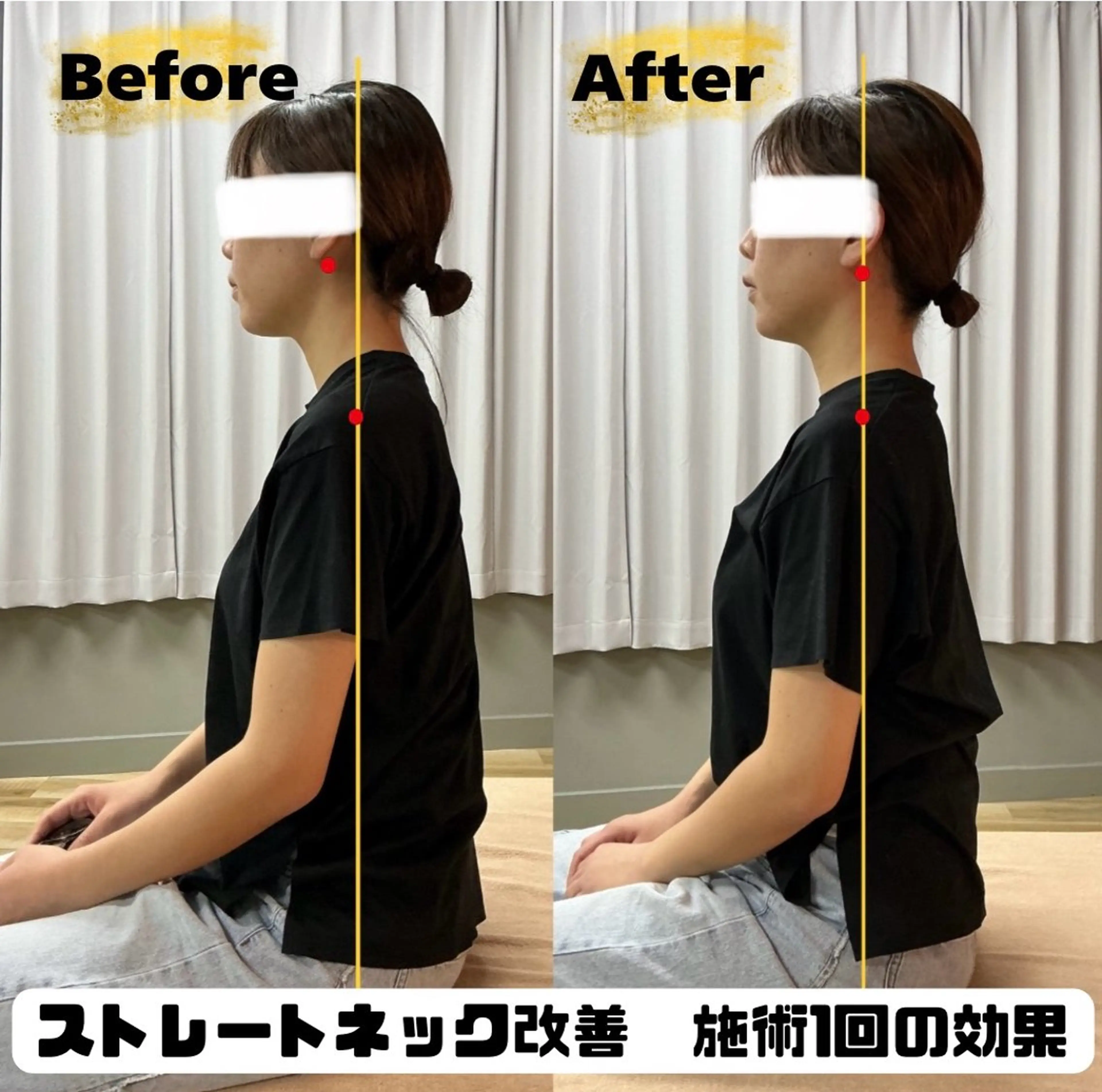 ミニモ特集　期間限定　ストレートネック改善　40分          🌸お写真掲載OKの方限定🌸の写真