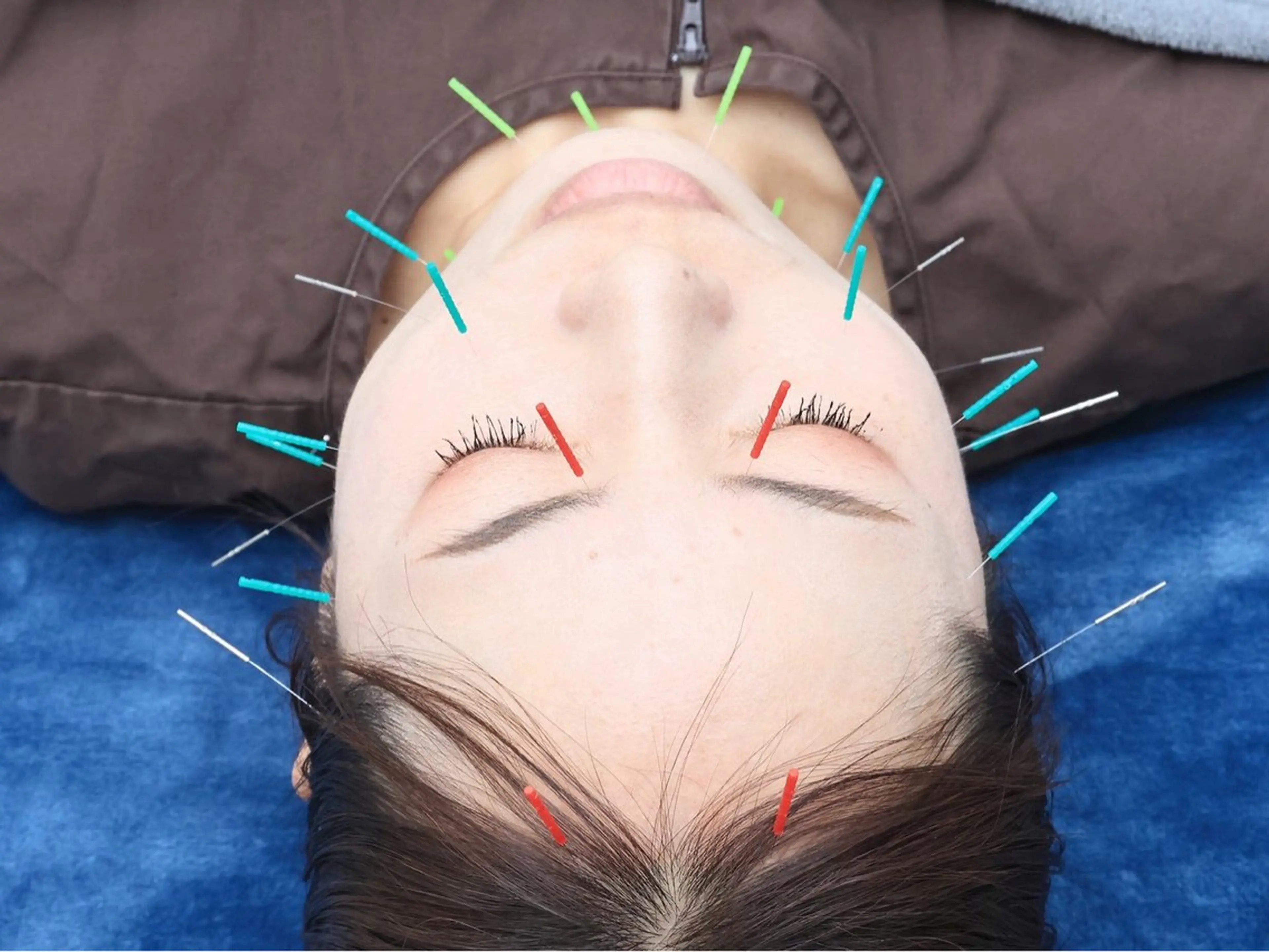 美容鍼・小顔矯正 FLOW 鍼灸整体院のその他イメージ