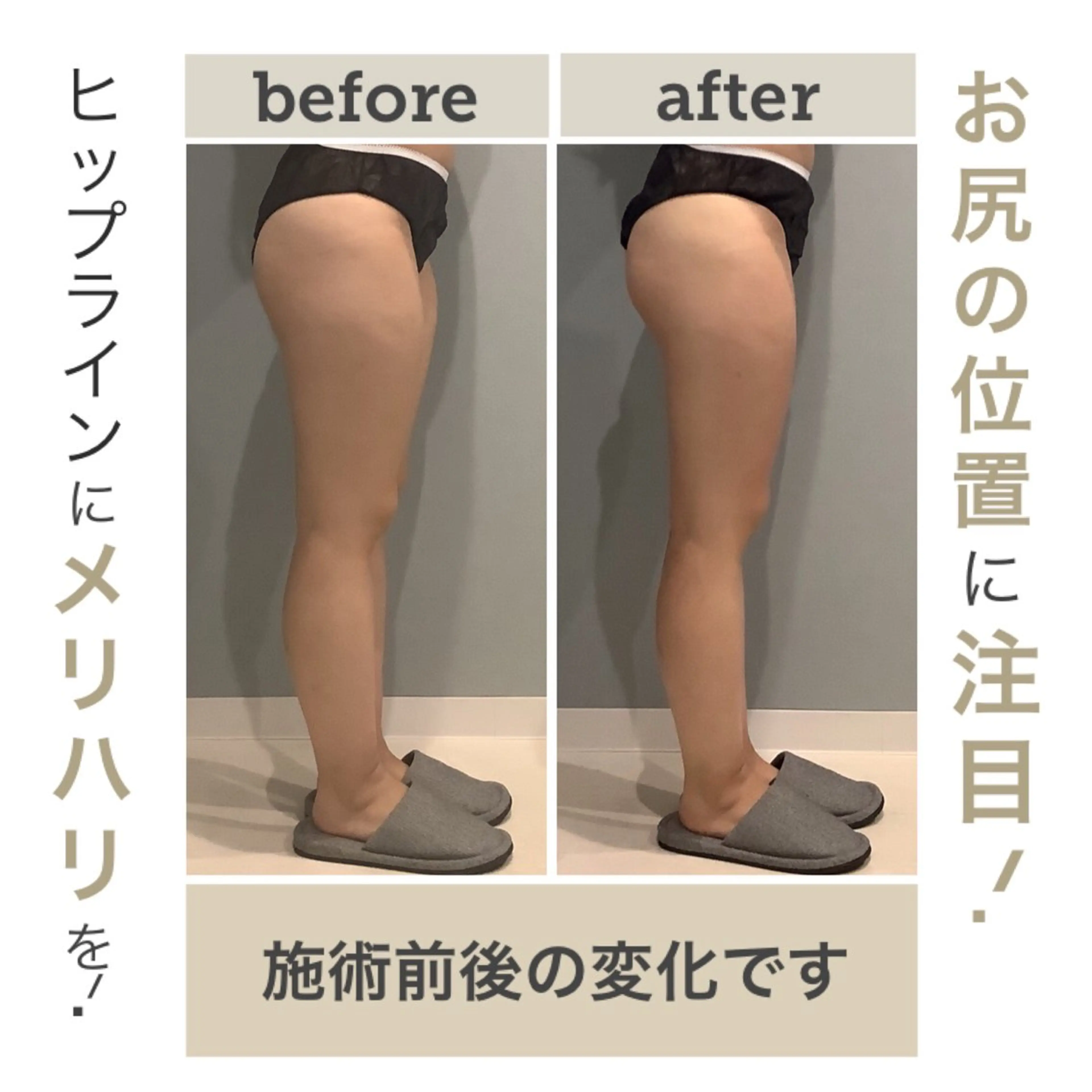 エステ エステサロン JURISのエステ・リラクイメージ