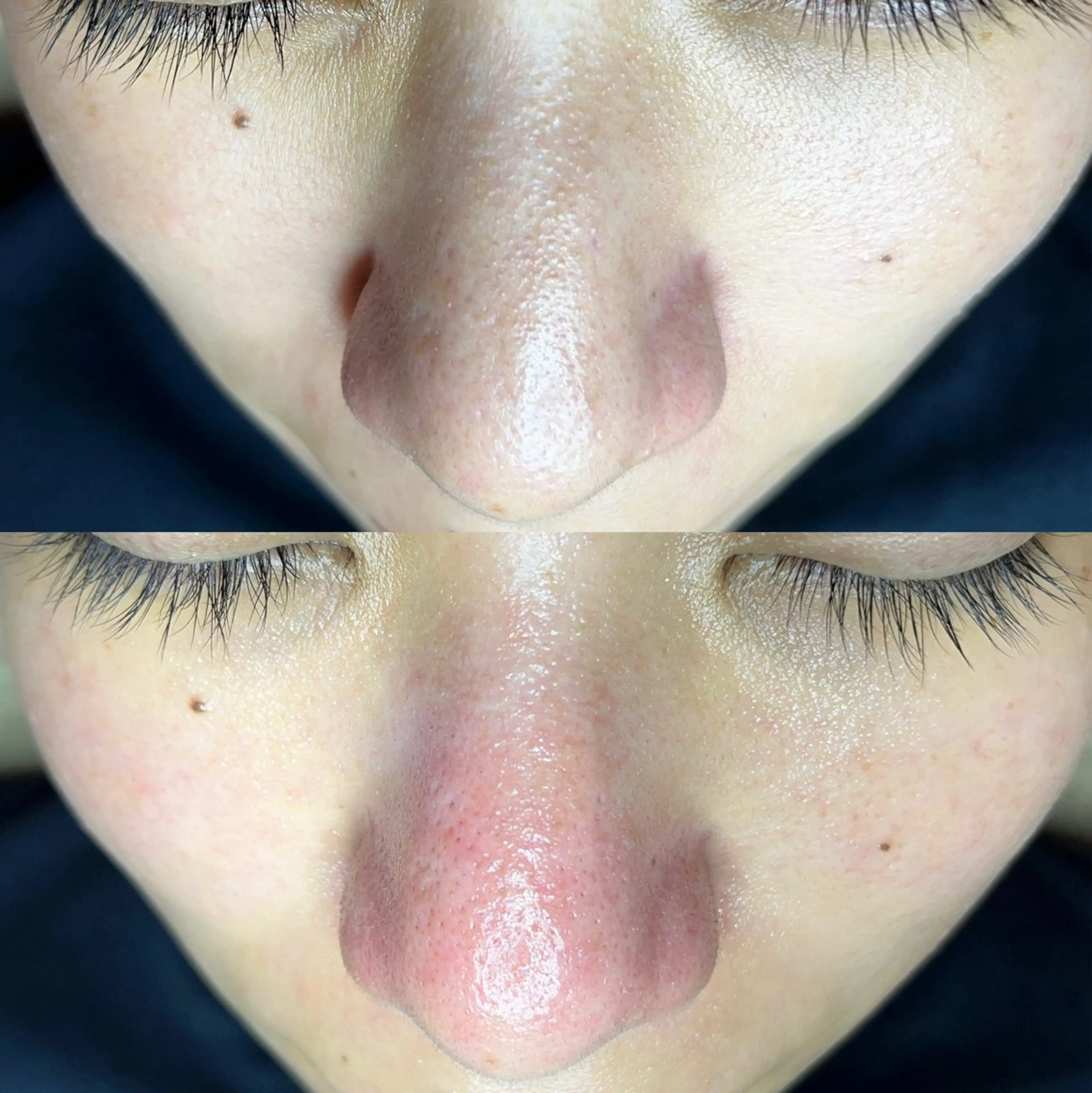 毛穴ケア・ヘッドスパ サロンSHINYのエステ・リラクイメージ