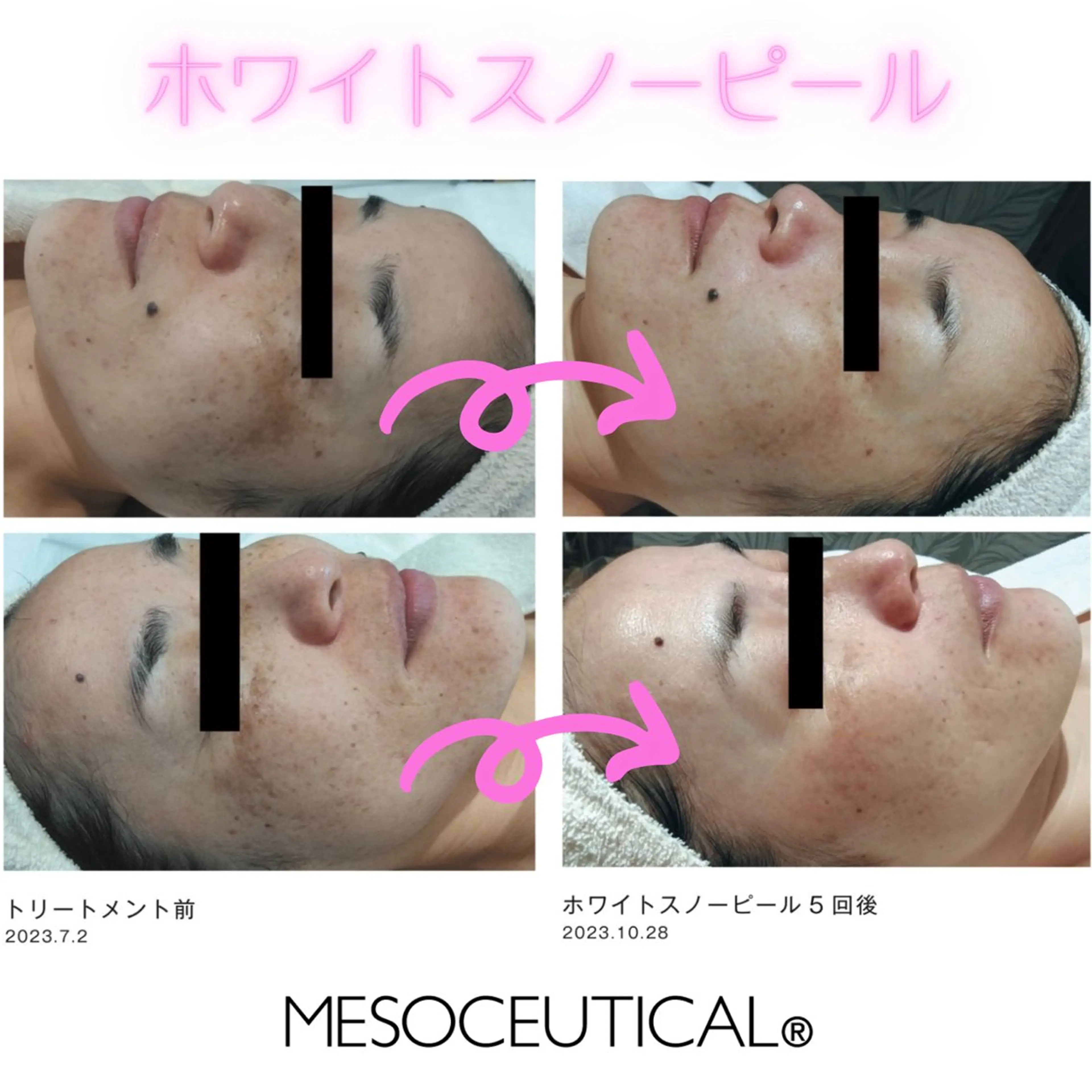 アドミーロ 🎀CHIKA🎀のエステ・リラクイメージ