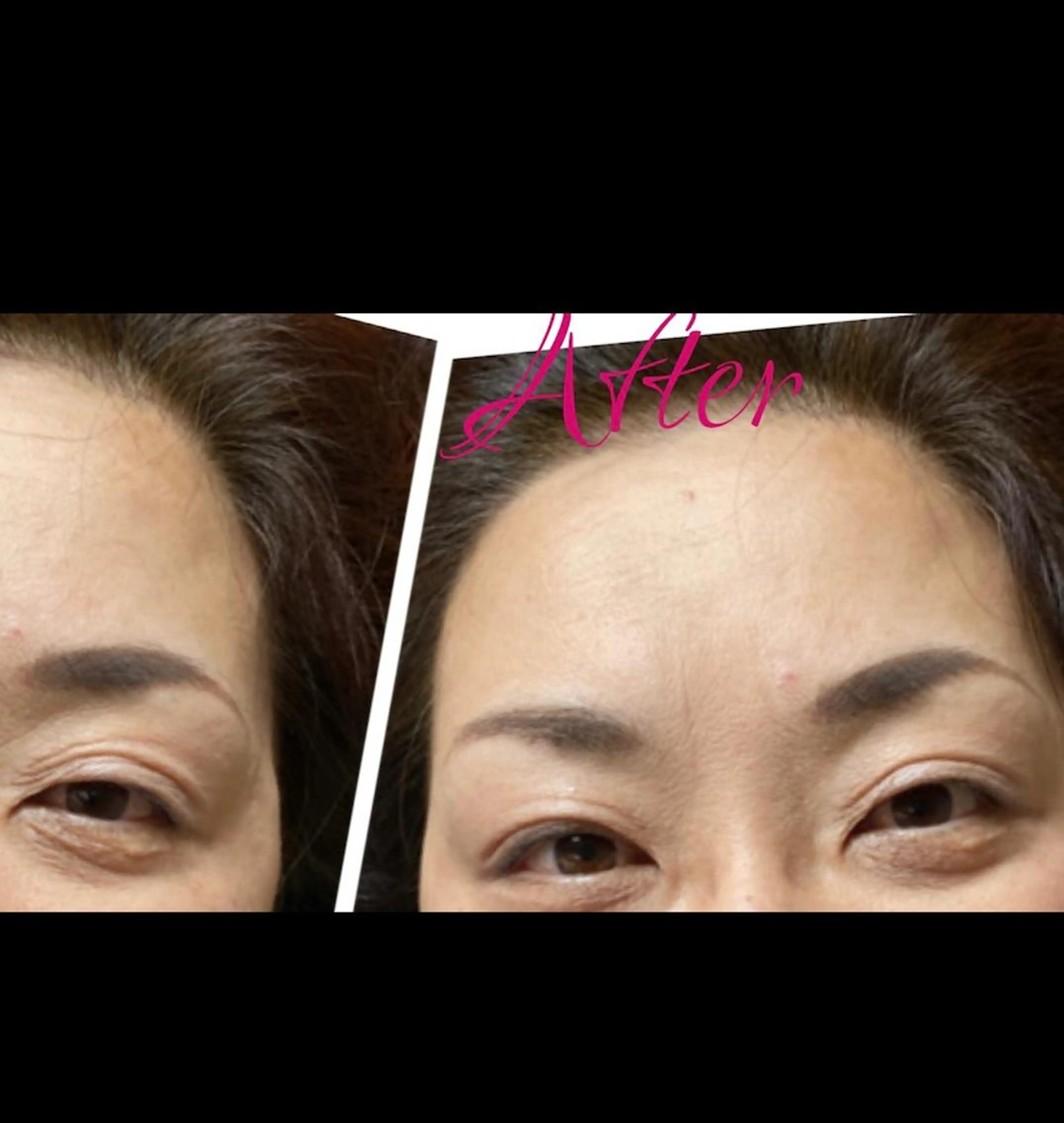 Anne’s happyBonesのエステ・リラクイメージ