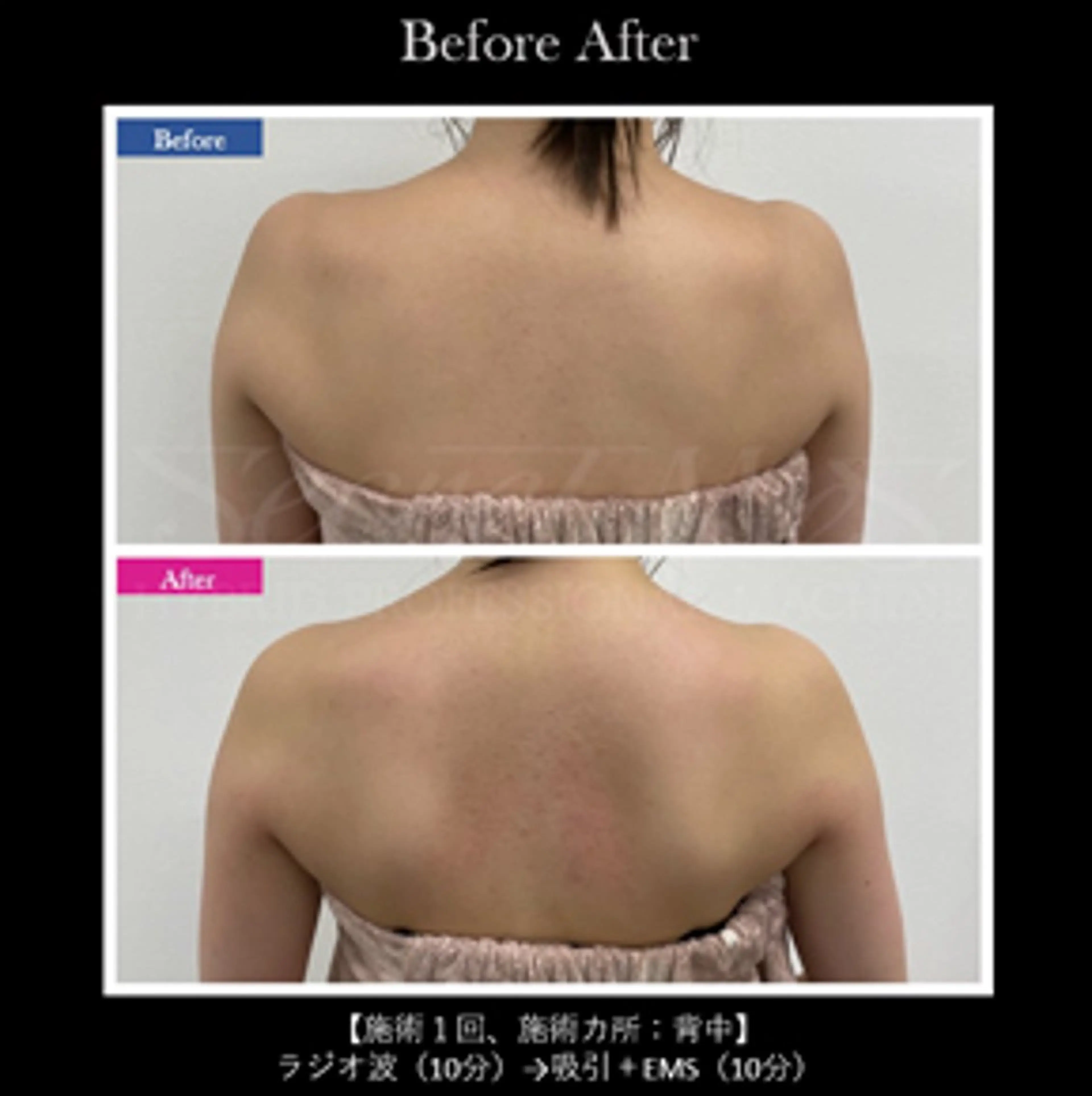 伊藤 正美のマツエク・マツパデザイン