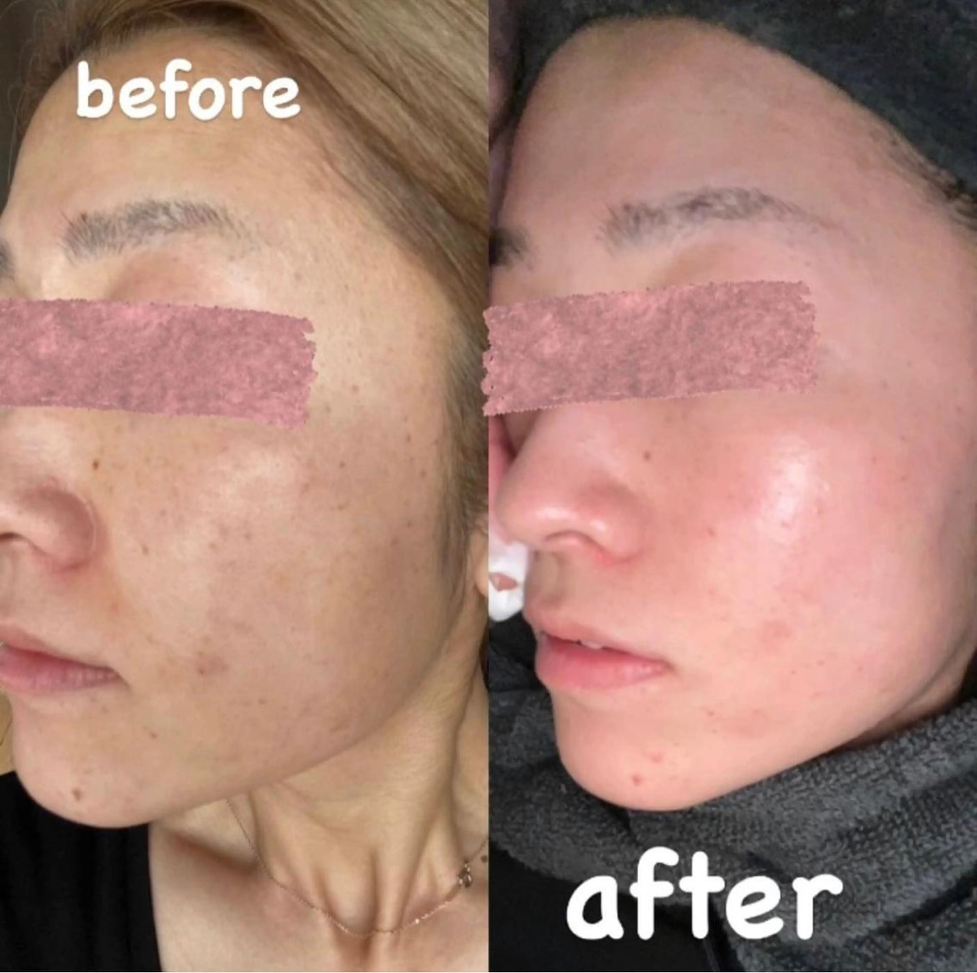 beauty lanaのエステ・リラクイメージ