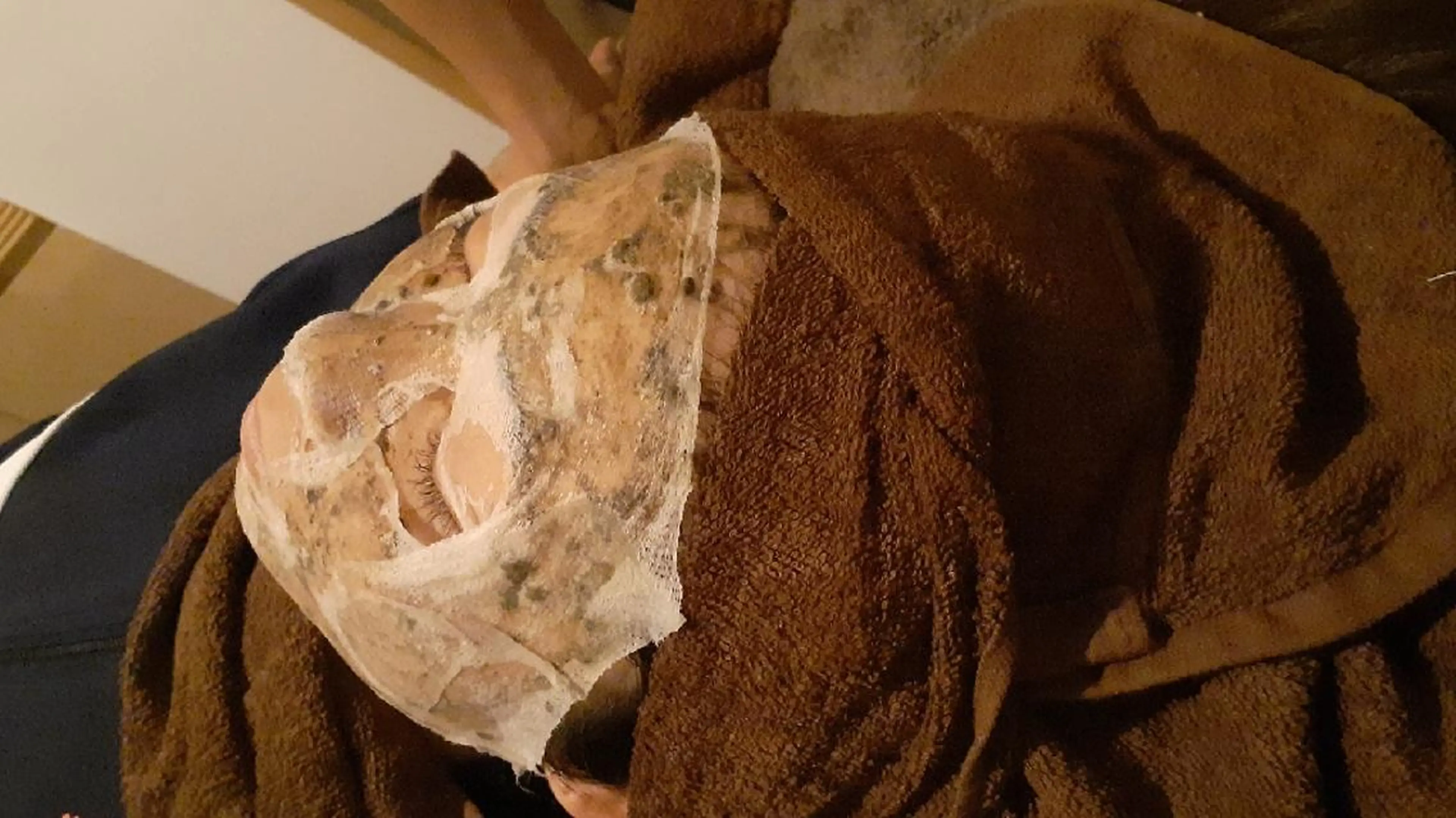 🌿リピ　　ハーブピーリング　ソフト(センシティブでは物足りない、ハードではきつすぎる方)    リンパマッサージ付の写真