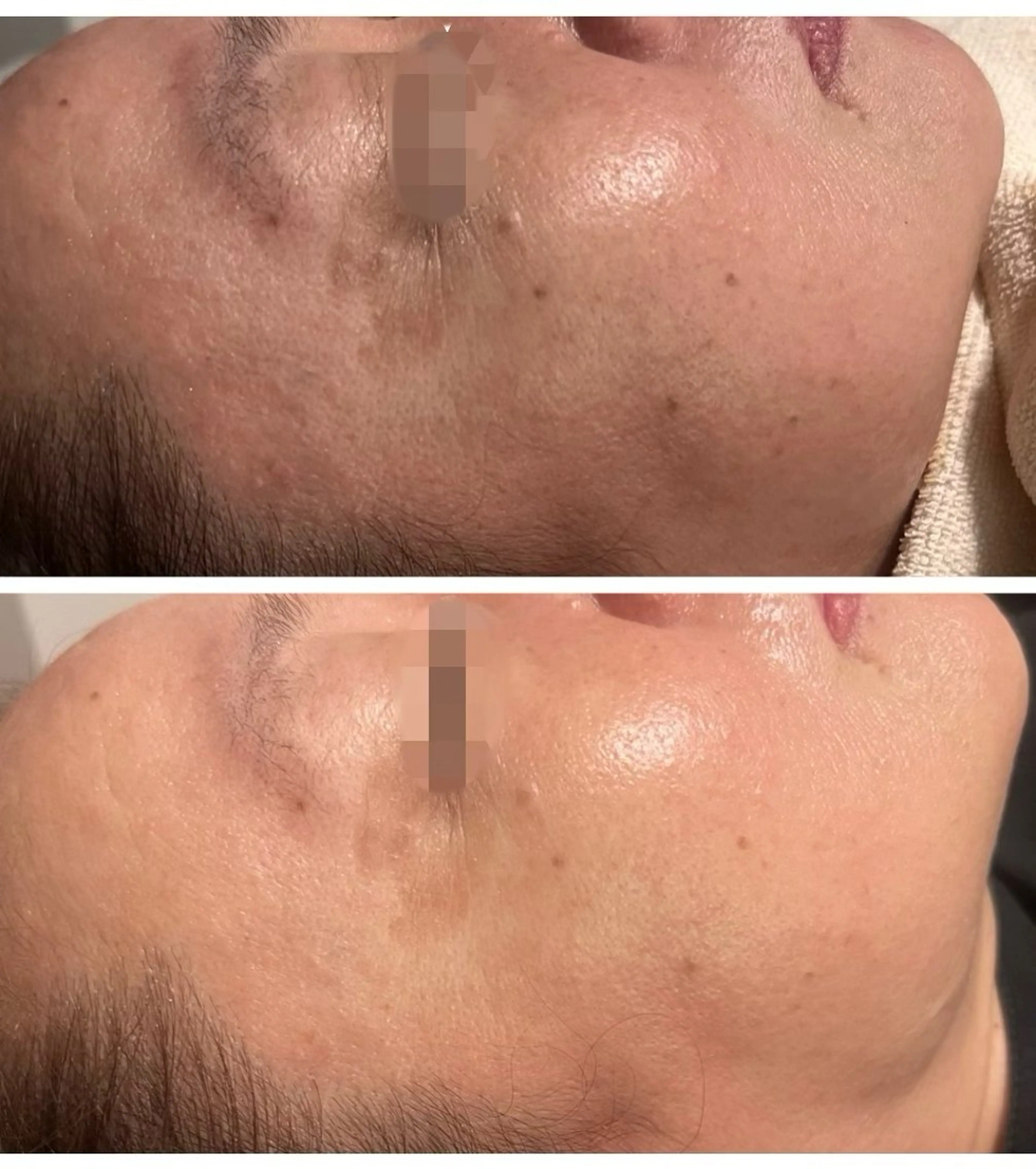 Raviy 【痩身・韓国肌管理】のエステ・リラクイメージ