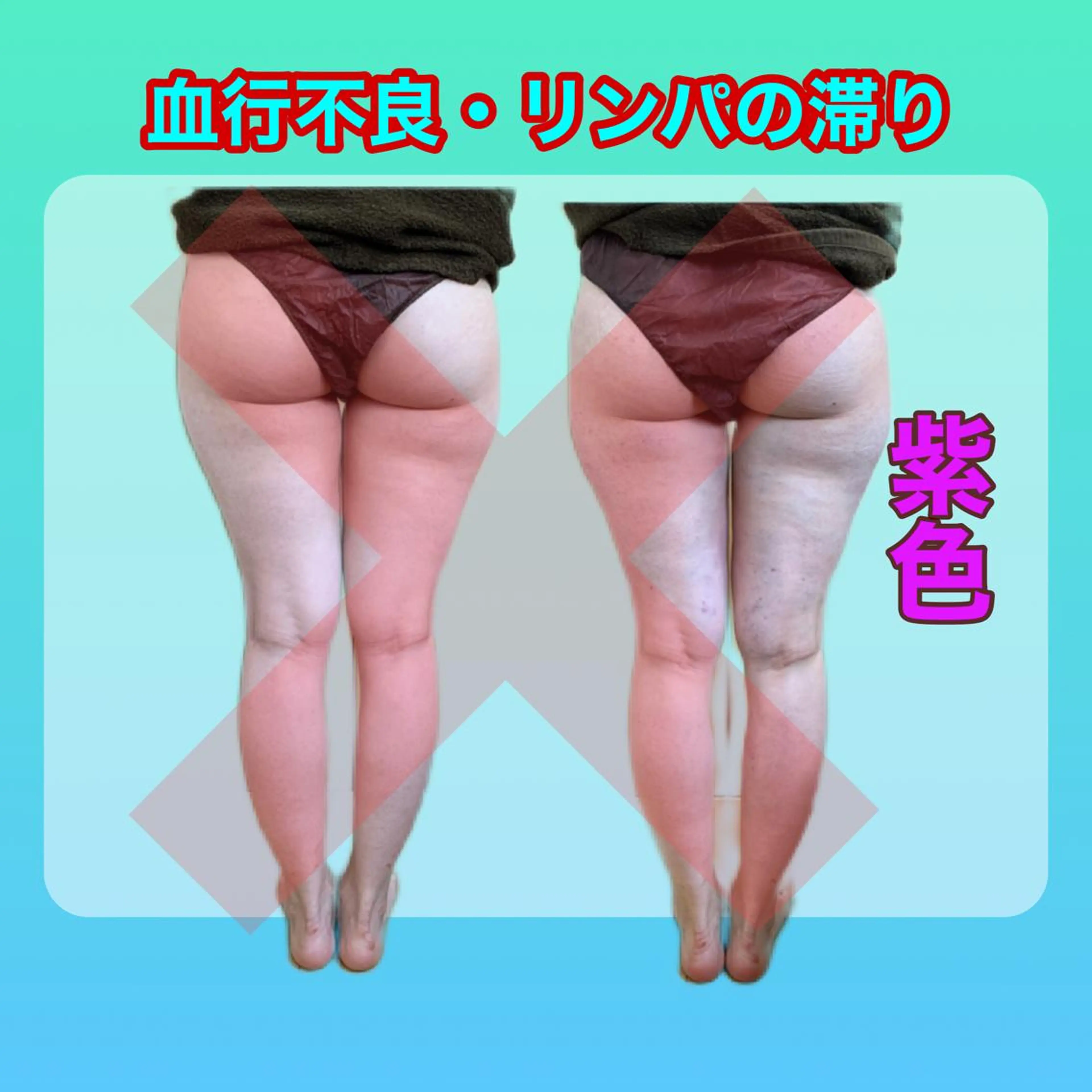 エステ リラク 痩身/脱毛/ネイル HARUKAのエステ・リラクイメージ