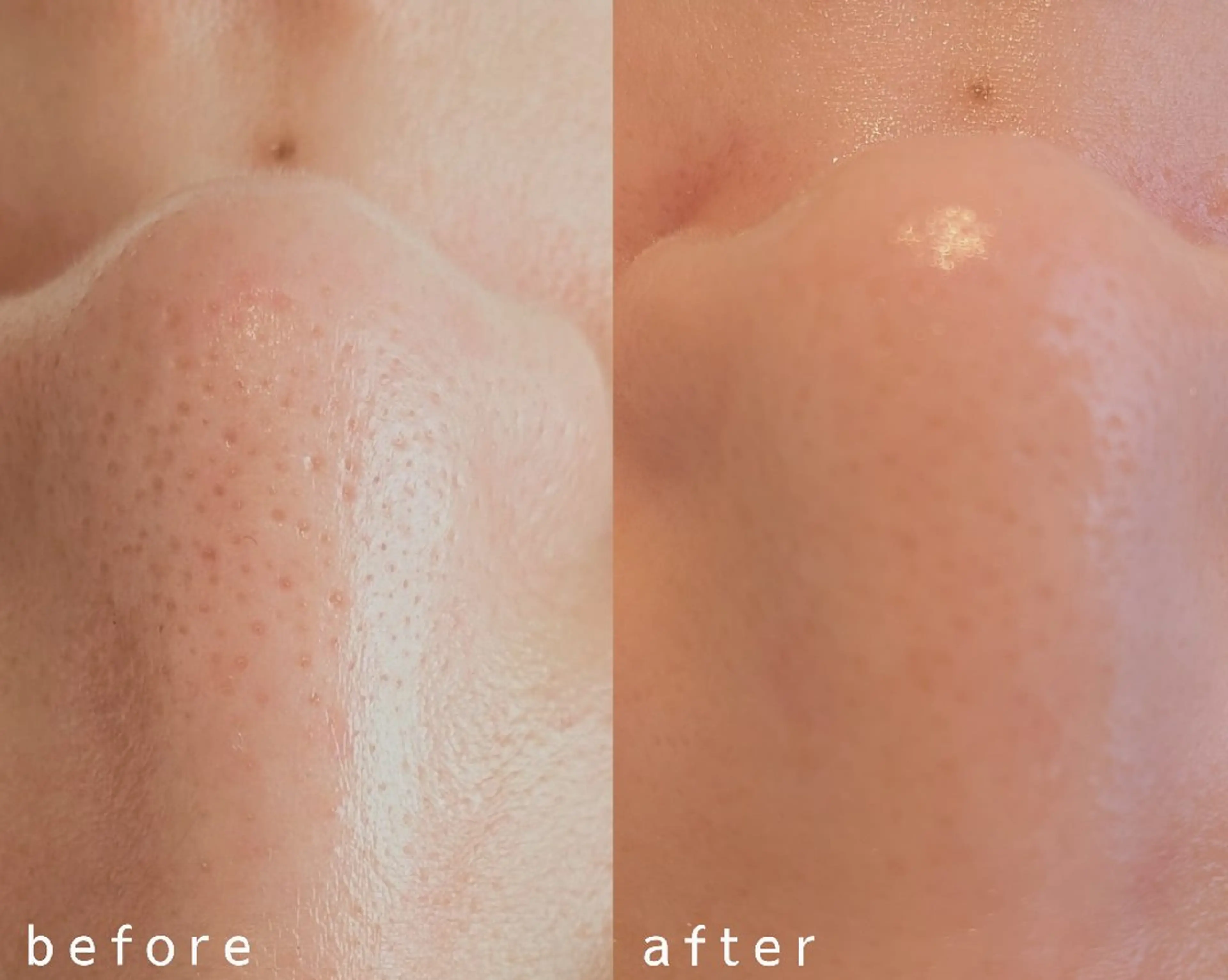 フェムケア＆フェイシャルサロン Brillia Moi所属・フェムケアよもぎ蒸し BrilliaMoiのエステ・リラクイメージ