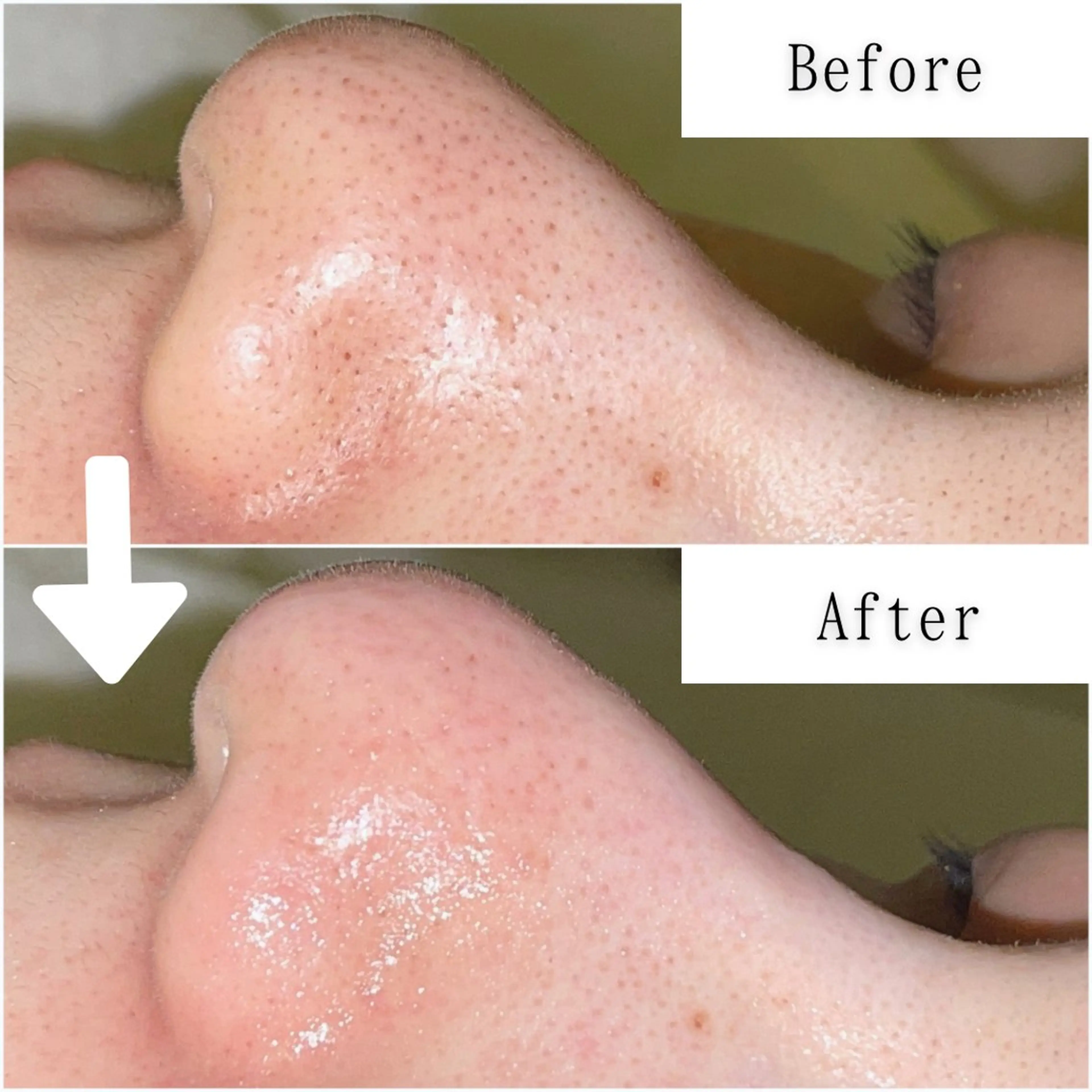 エステ SELF  BEAUTY gracia浦添店所属・gracia 浦添店のその他イメージ