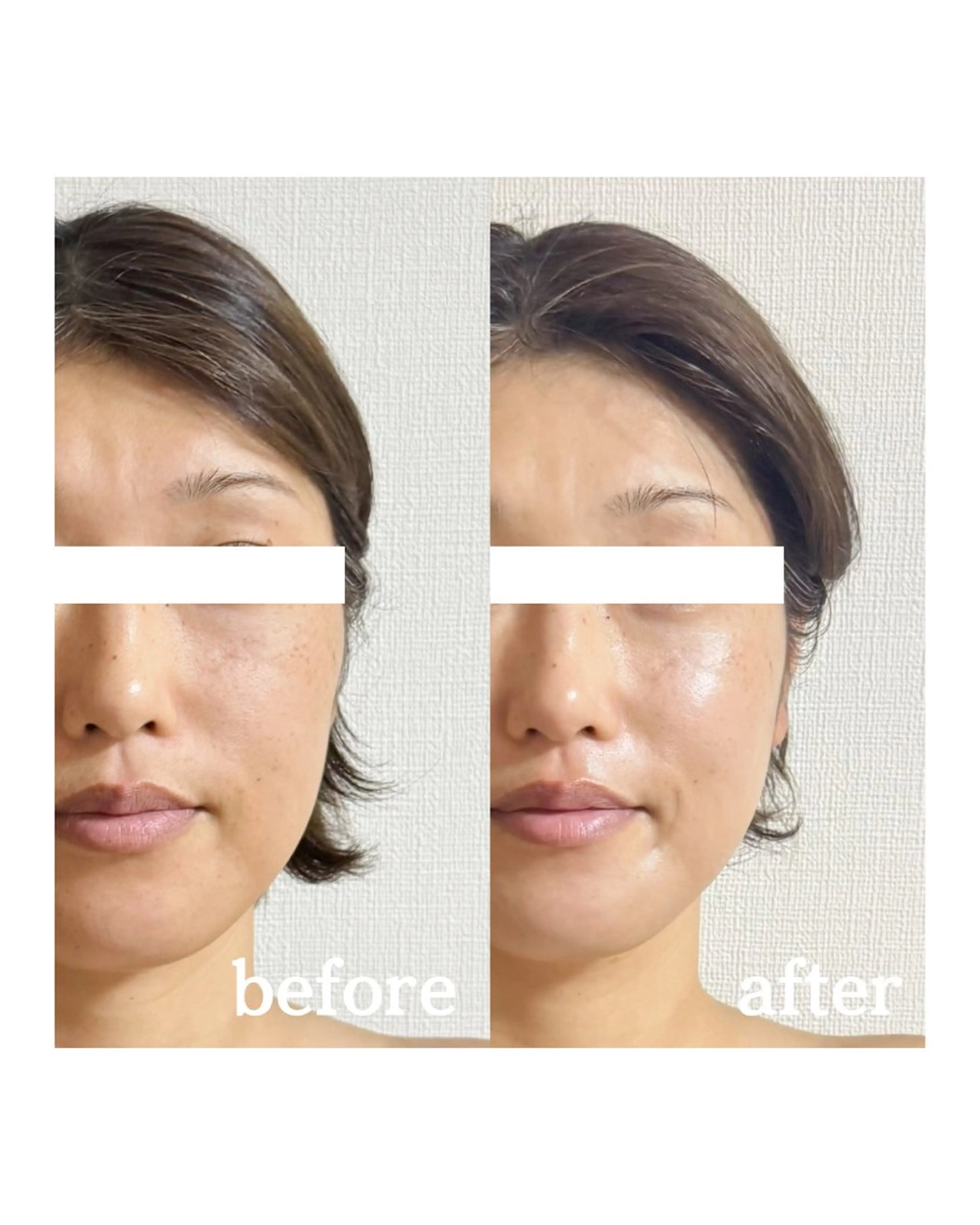 Mignon Luluのエステ・リラクイメージ