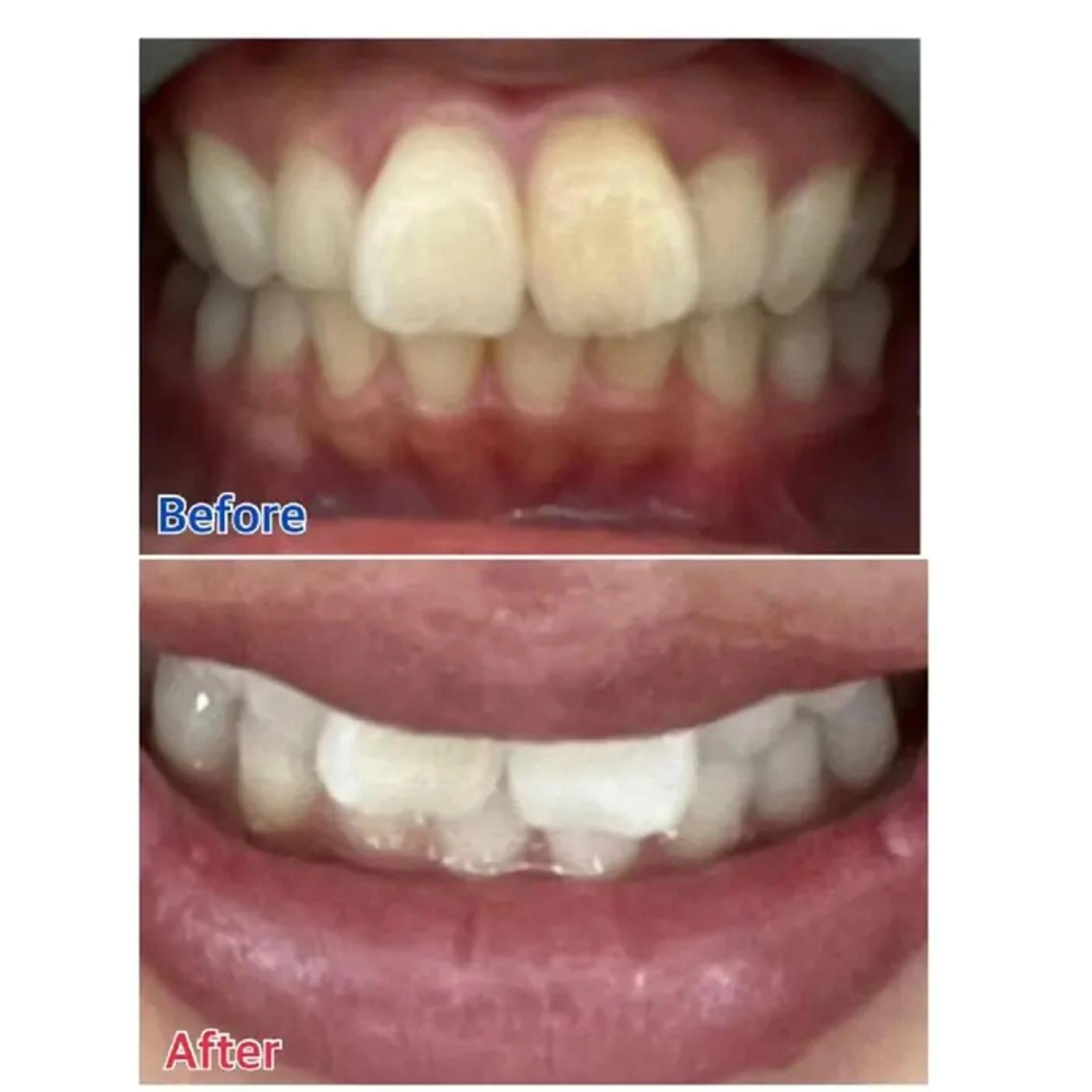 Ｍ渋谷 ホワイトニングのエステ・リラクイメージ