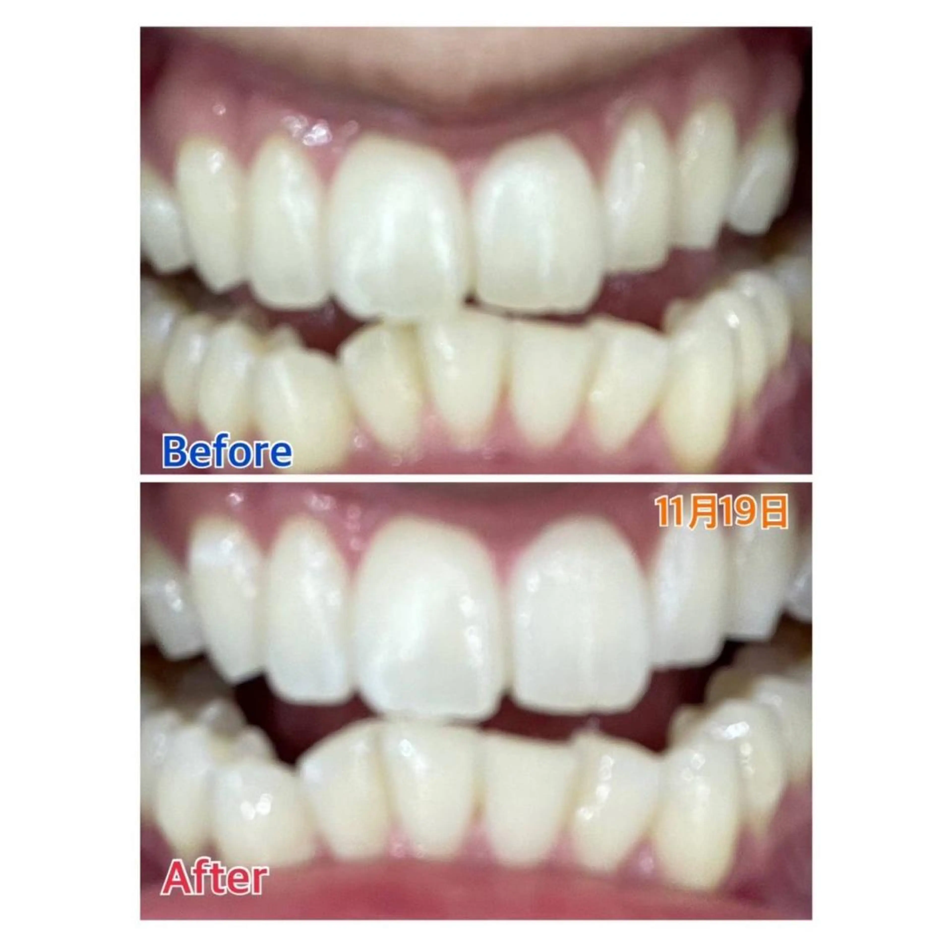 MBEAUTYSALON 千葉店・京成大久保所属・Melty 輝のその他イメージ