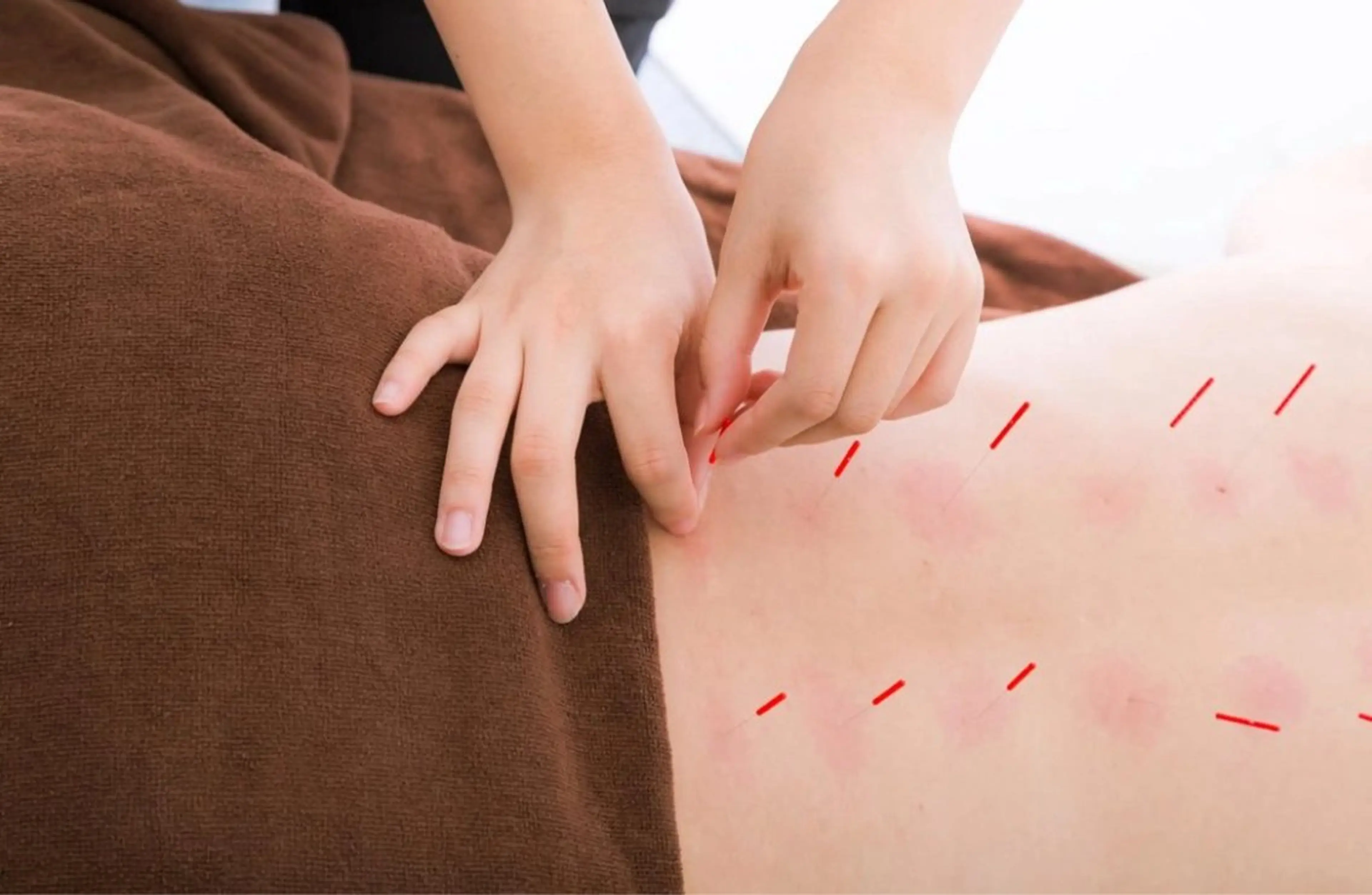 エステ リラク 美容鍼・整体 根本改善/北村 友二のエステ・リラクイメージ