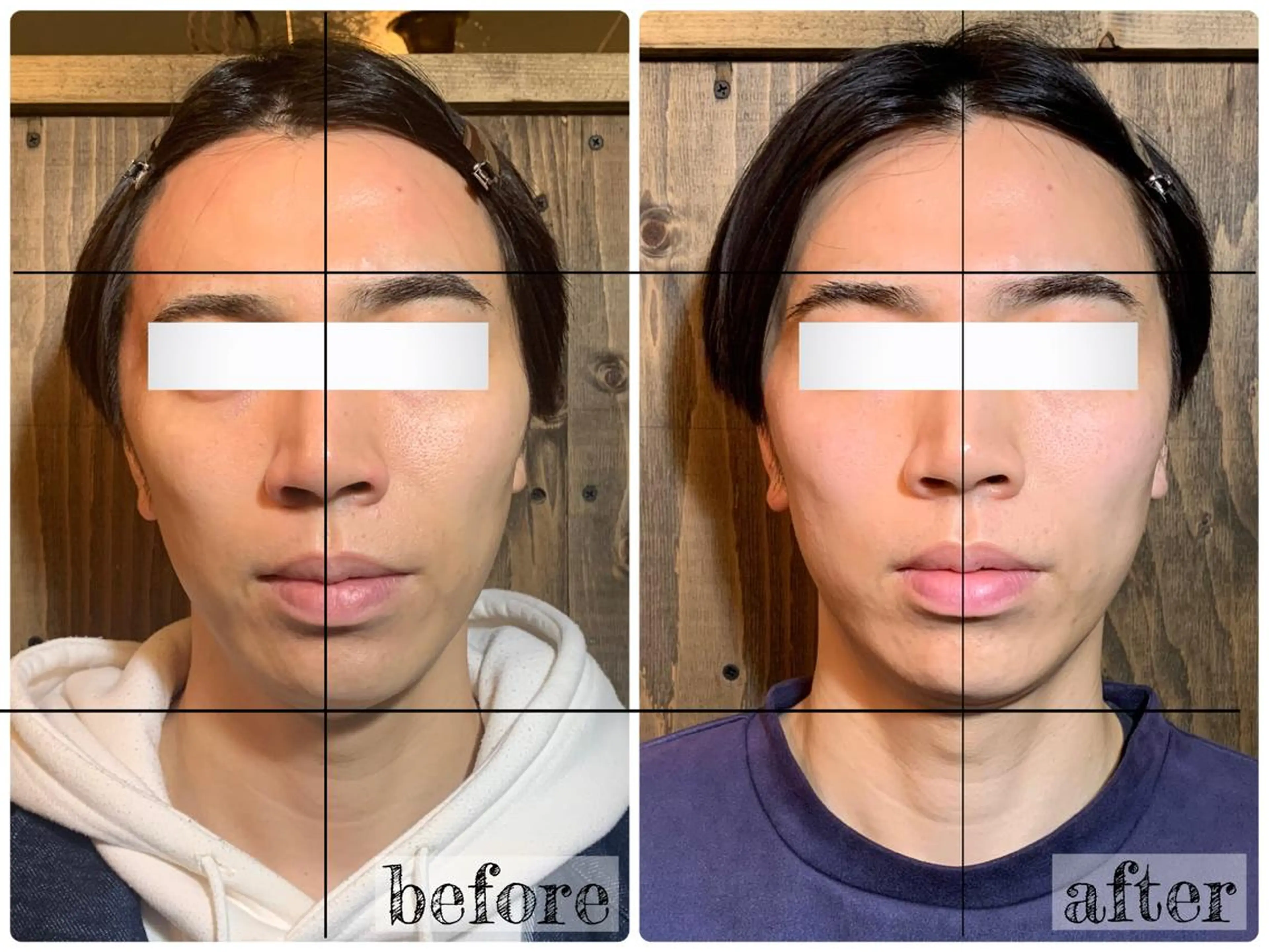 エステ リラク 💎後悔させない小顔 矯正💎イトヤマ🌱のエステ・リラクイメージ