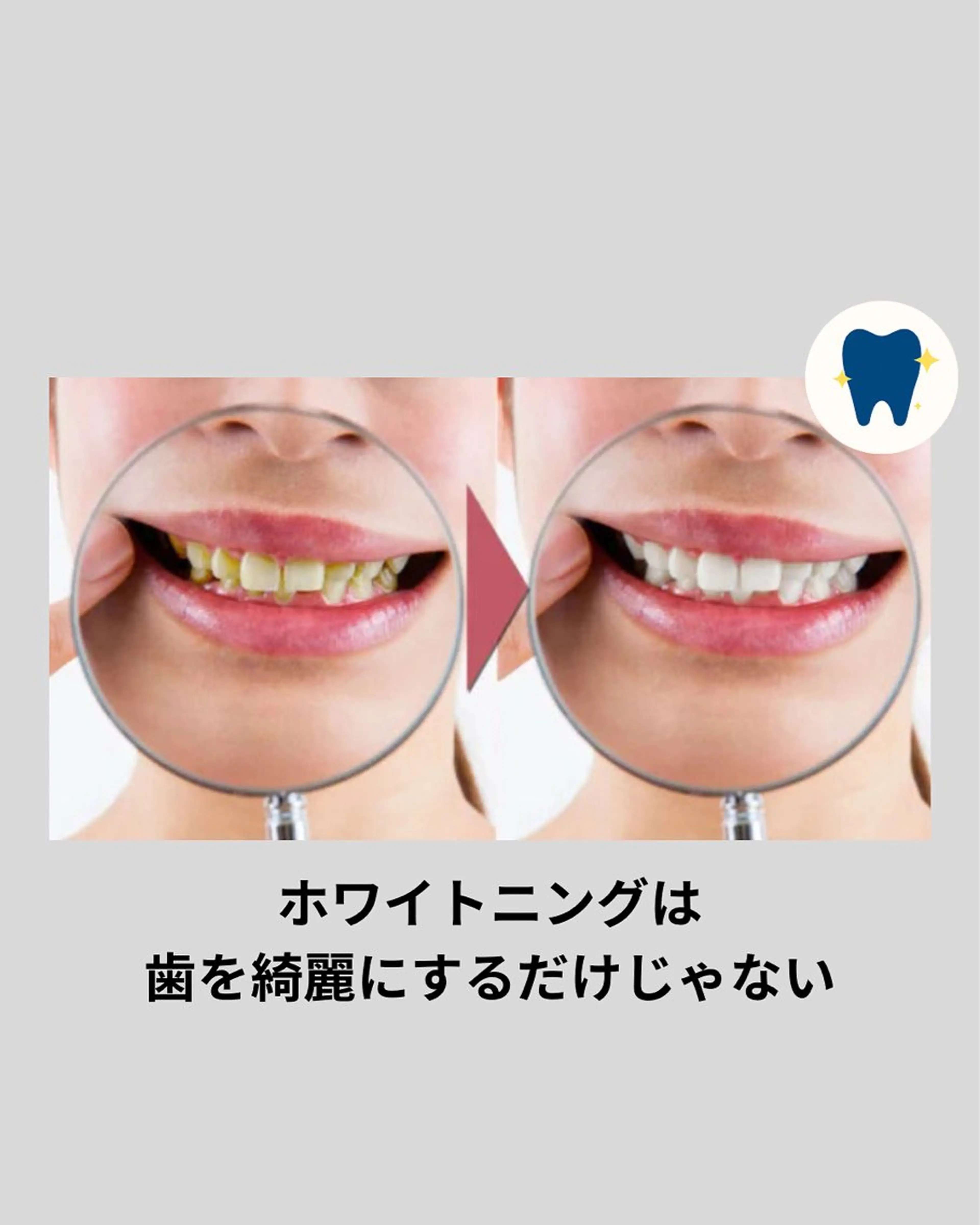 ホワイトニングショップ津店所属・ホワイトニング ショップ津店のその他イメージ