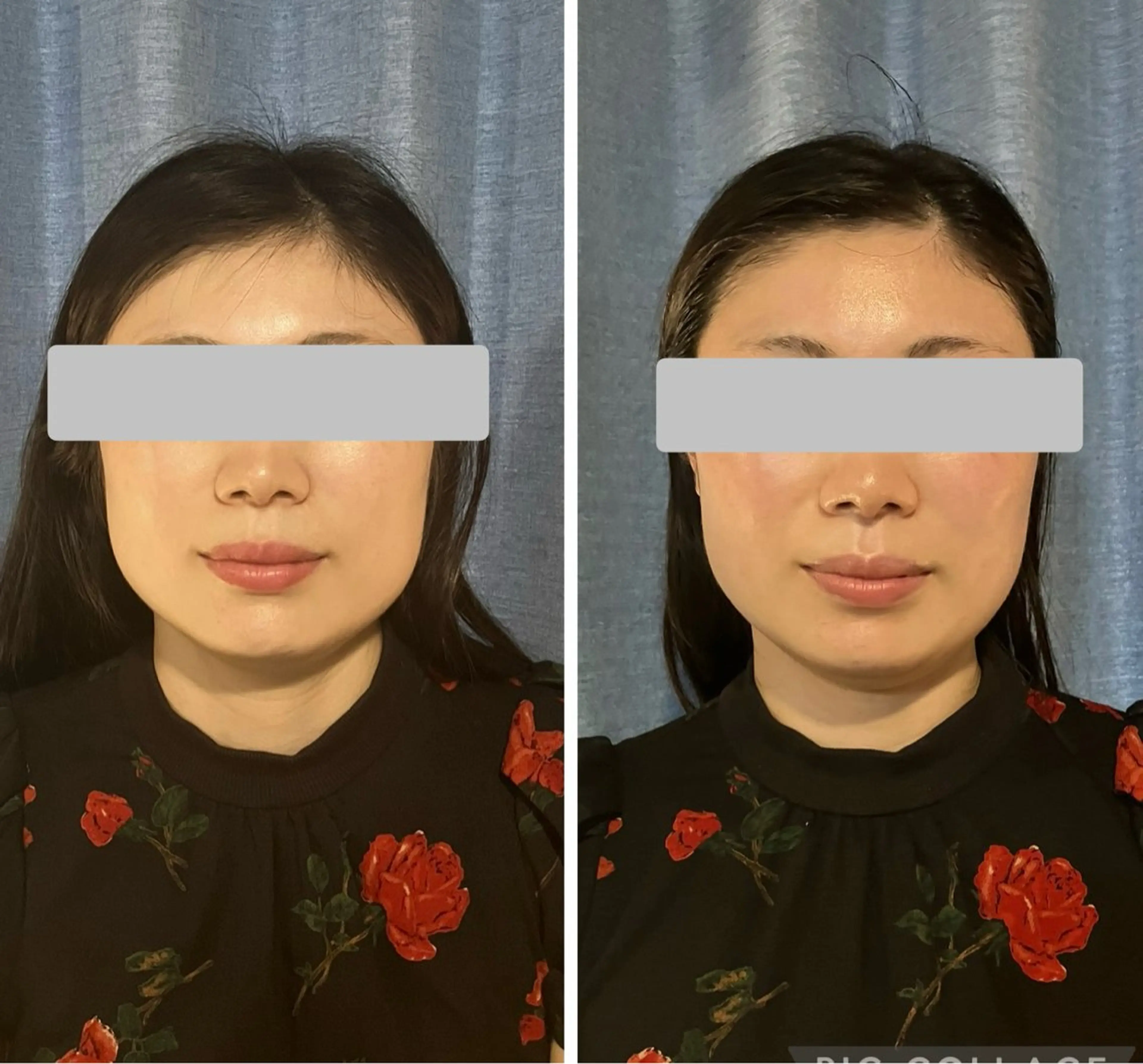 人気No. 1✨骨格整体×小顔リフトアップ×バストアップ❣️(セット)の写真
