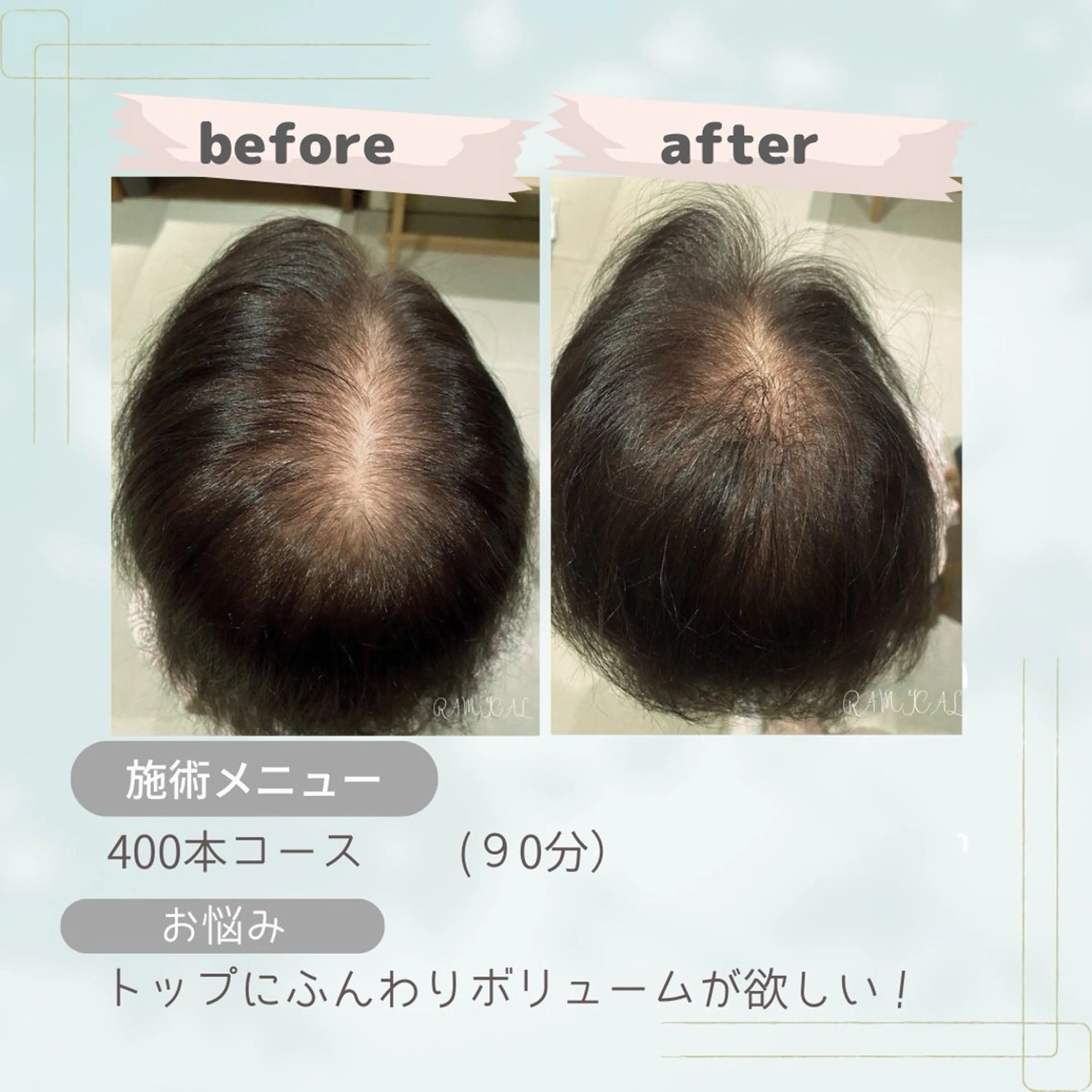 【全員OK】月イチメンテに◎定期ケア500本 通常¥22,000の写真