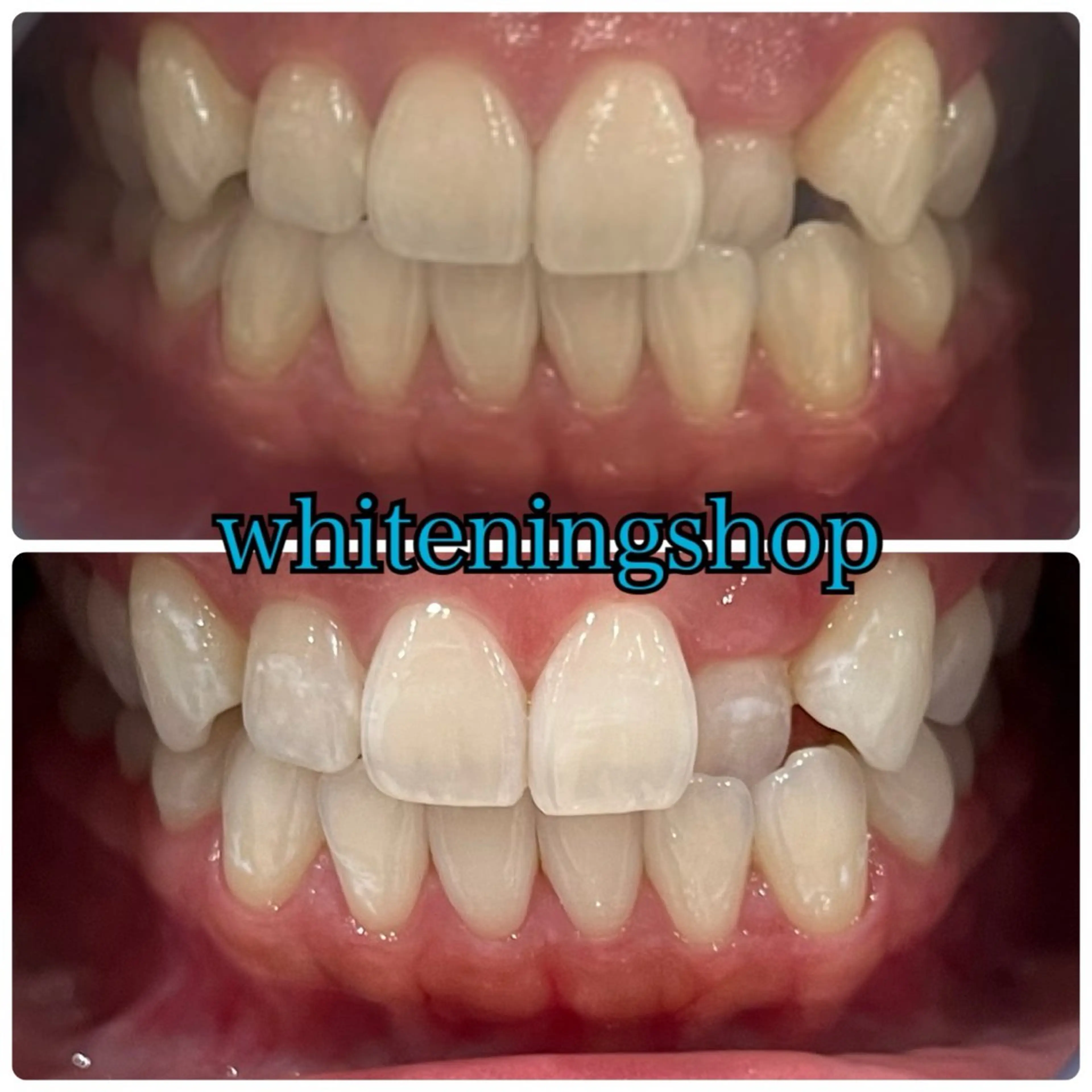 その他 ホワイトニング ショップ津店のその他イメージ