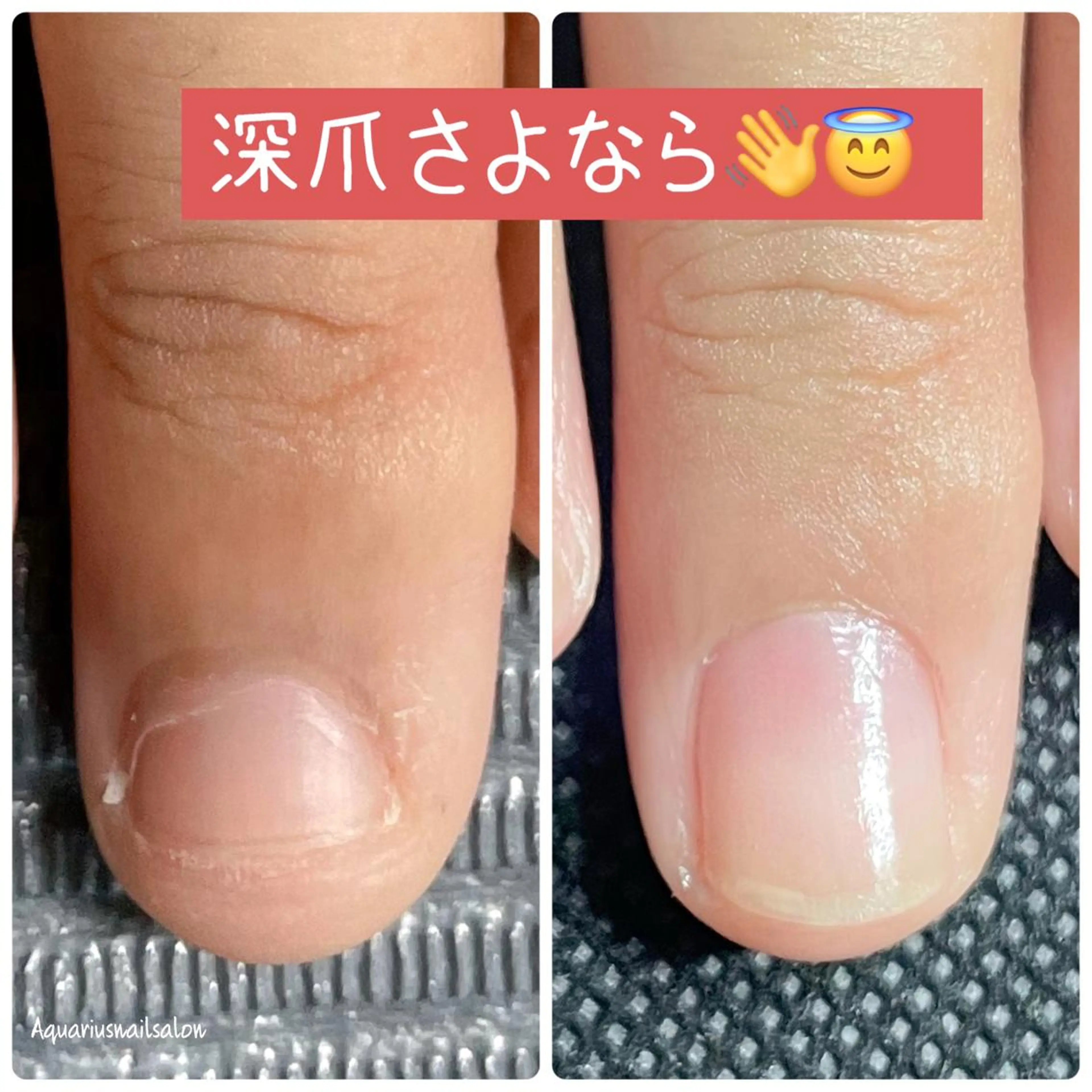 ネイル 奥園 良恵のネイルデザイン