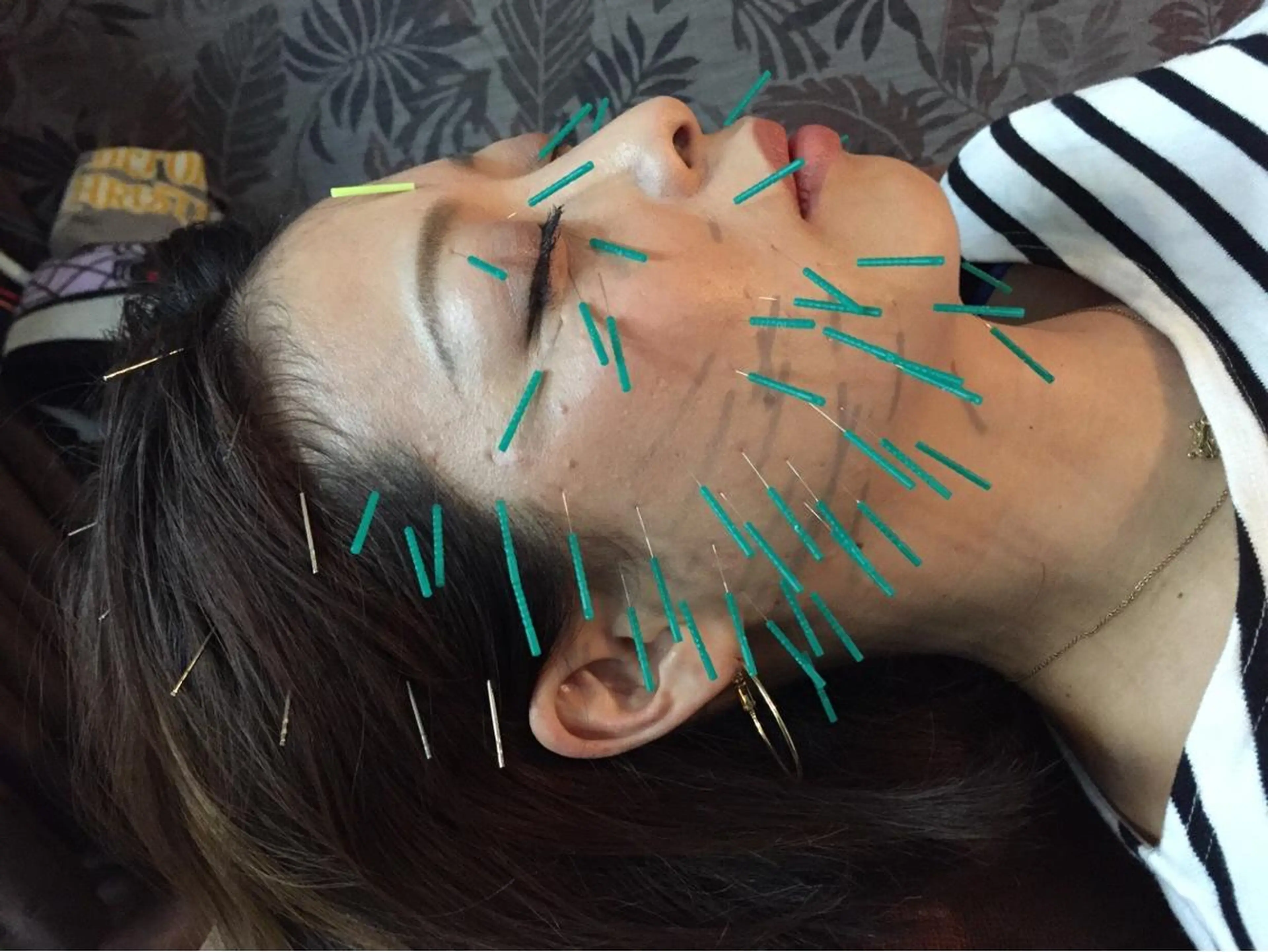 エステ リラク 美容鍼灸イロドリ  のエステ・リラクイメージ