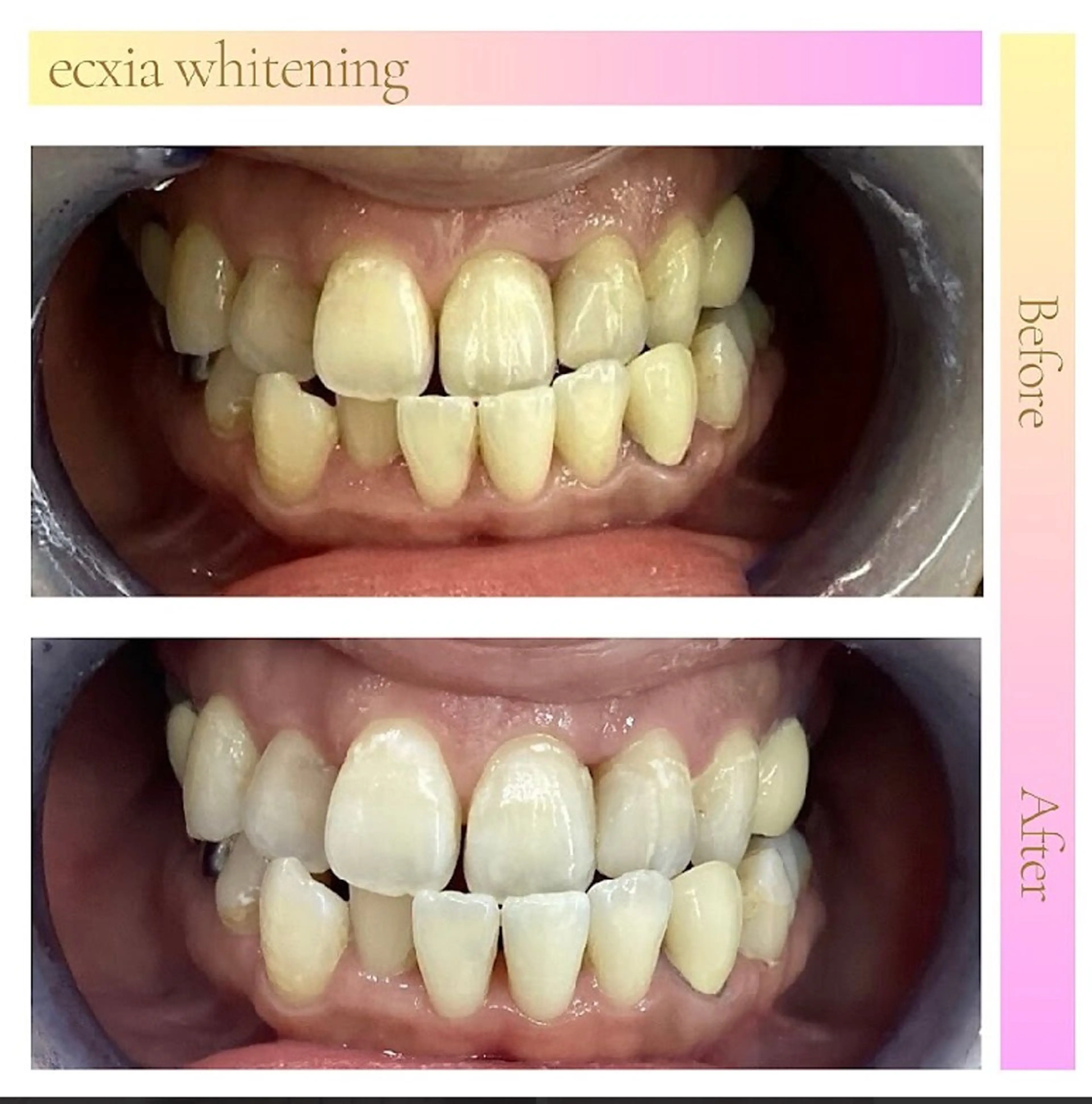 その他 nanami -ホワイトニングのその他イメージ