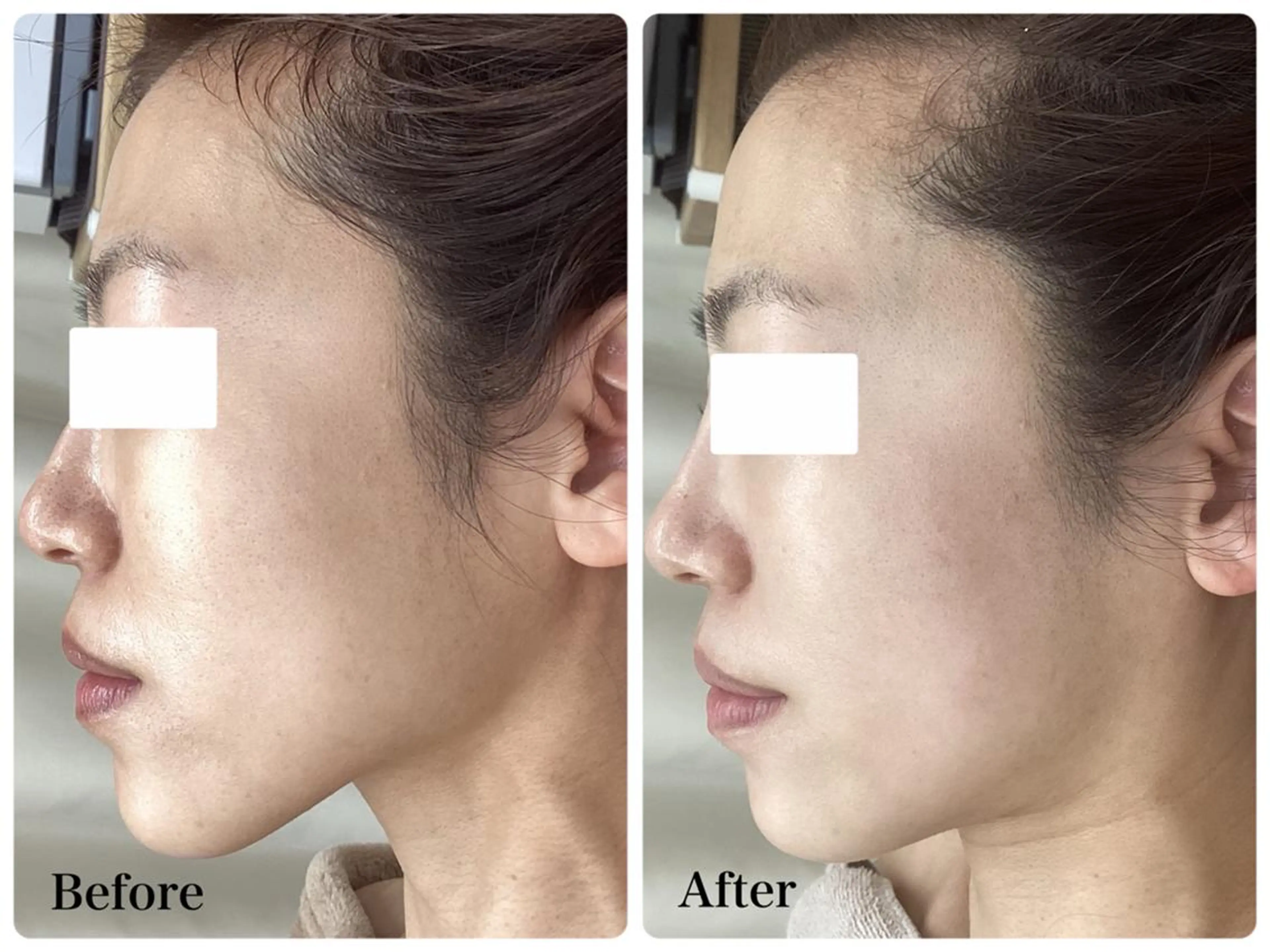 エステ リラク パーソナルエステ L'purのエステ・リラクイメージ