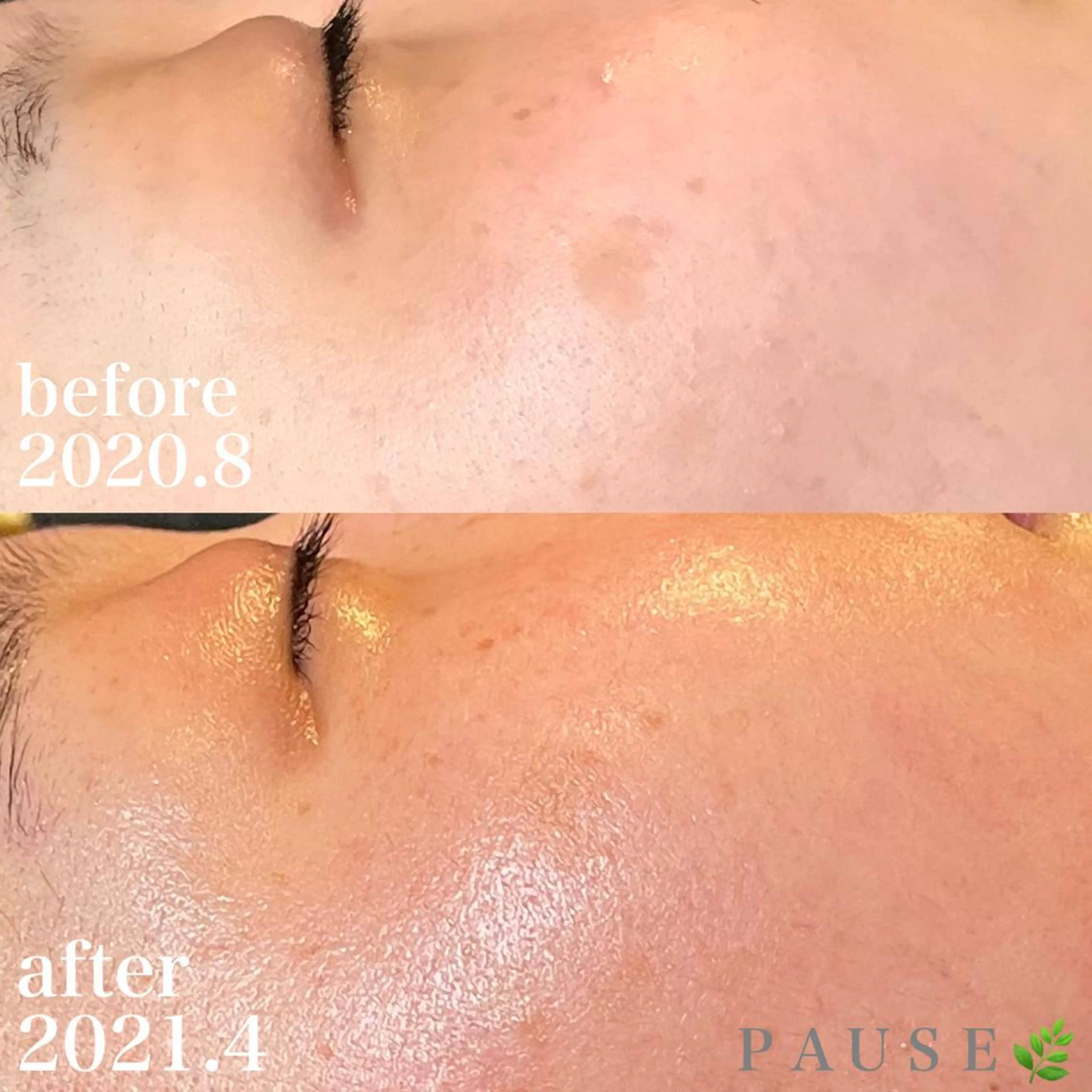 エステ 浜野 恵美のエステ・リラクイメージ