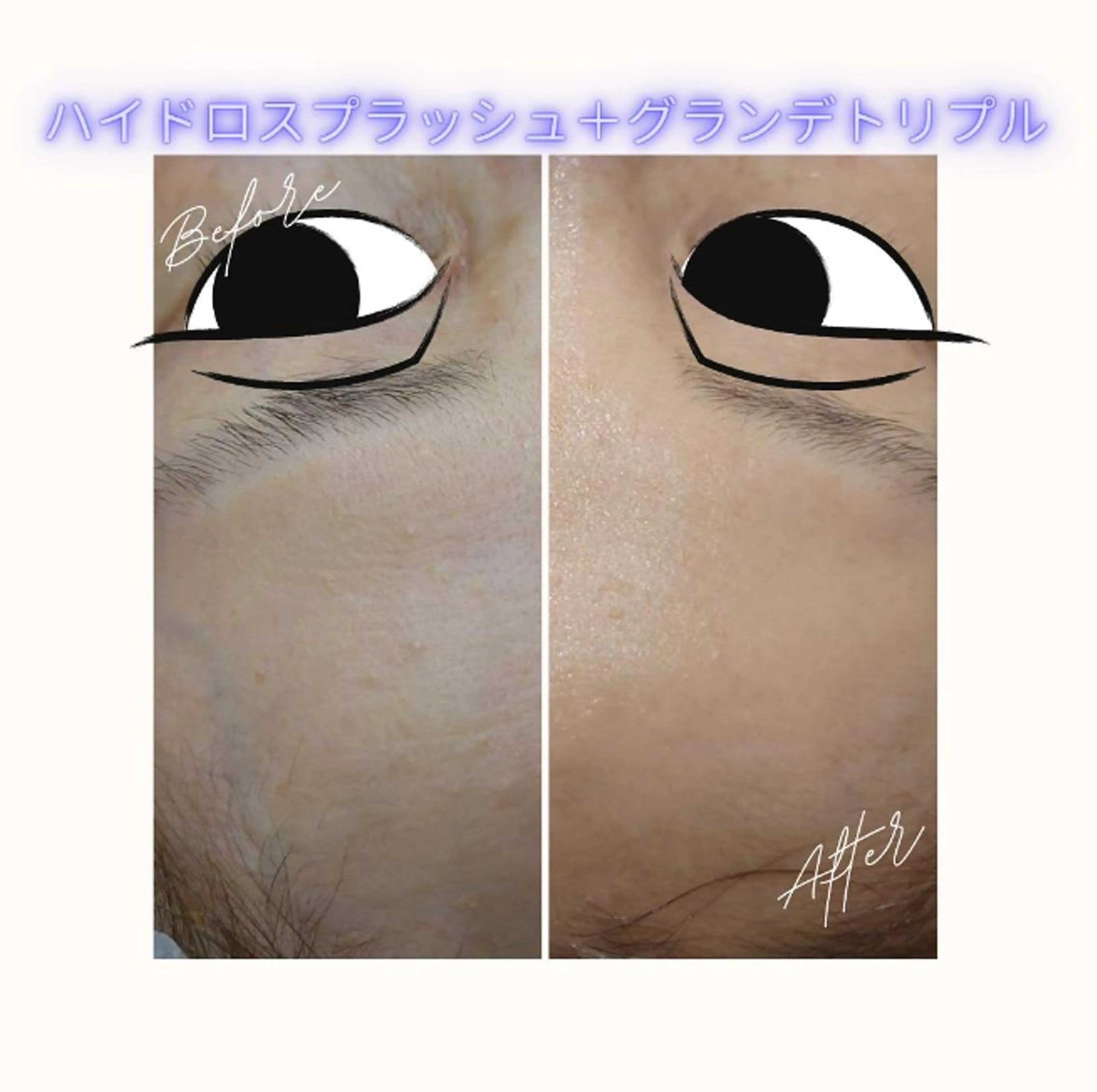 マツエク・マツパ ラブニール 恵比寿店のエステ・リラクイメージ