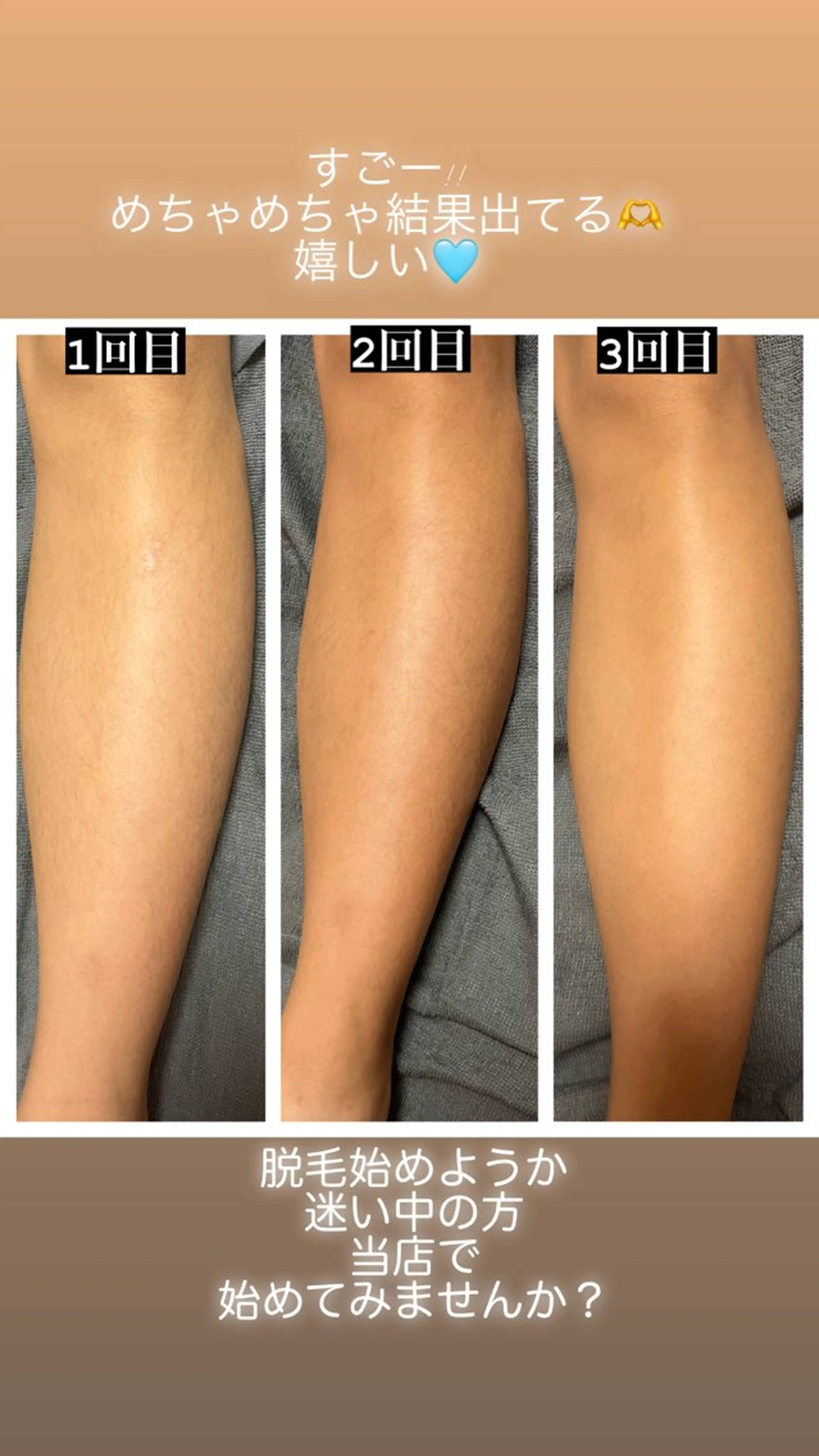 脱毛 perky所属・perky 羽島のマツエク・マツパデザイン