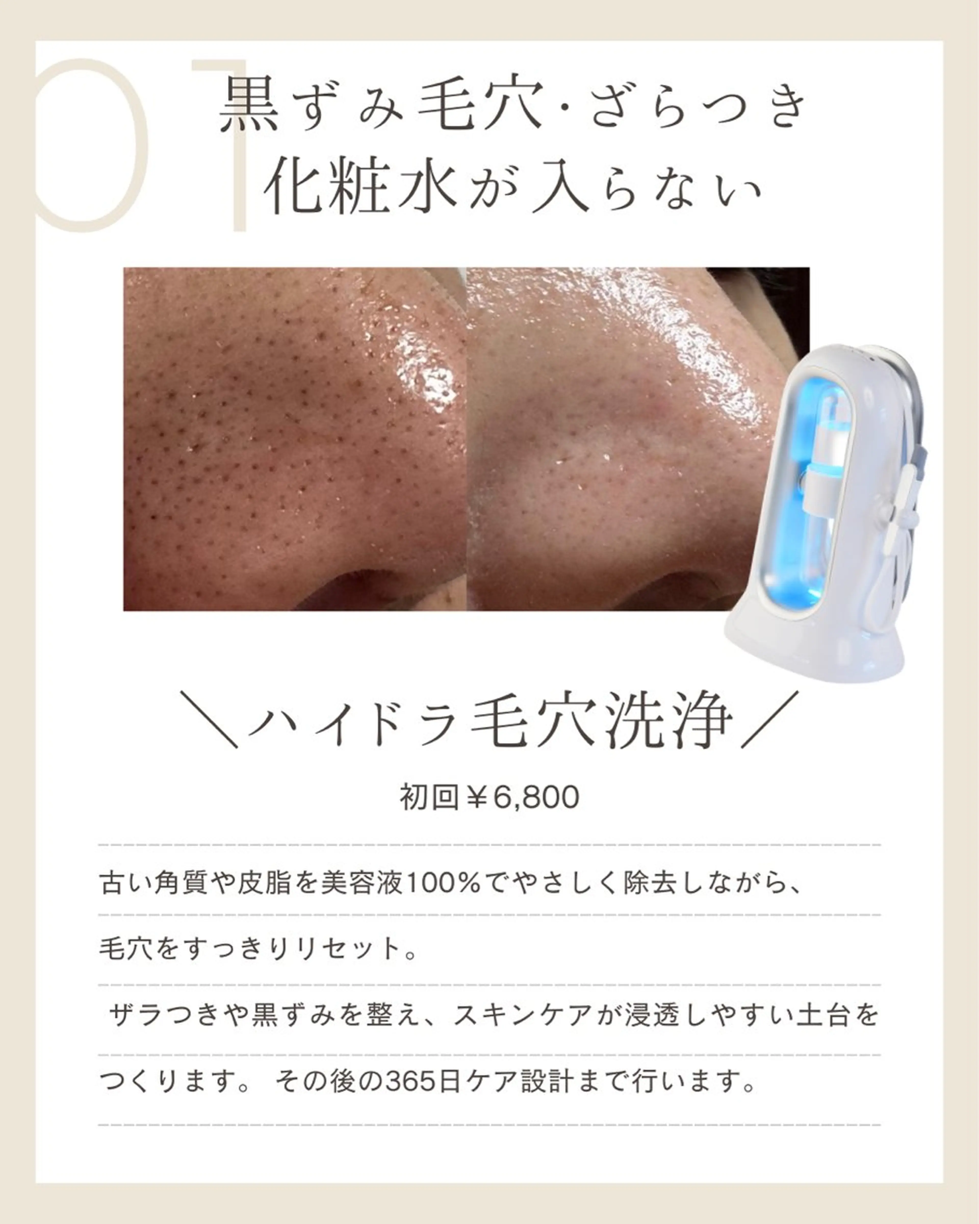 エステ 韓国美容専門店 LittleBlueのエステ・リラクイメージ