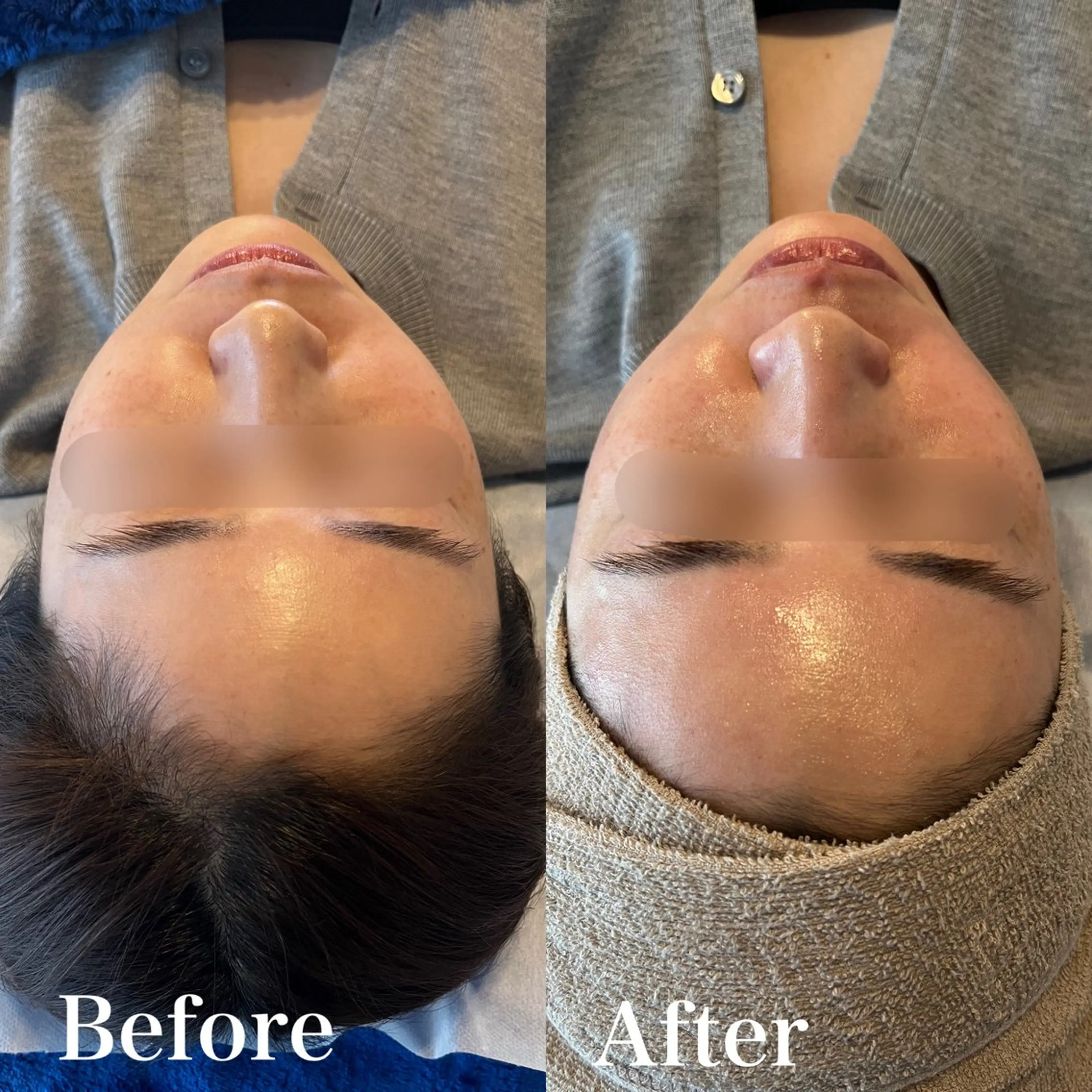 脱毛 wax脱毛専門店 ハイラントのエステ・リラクイメージ