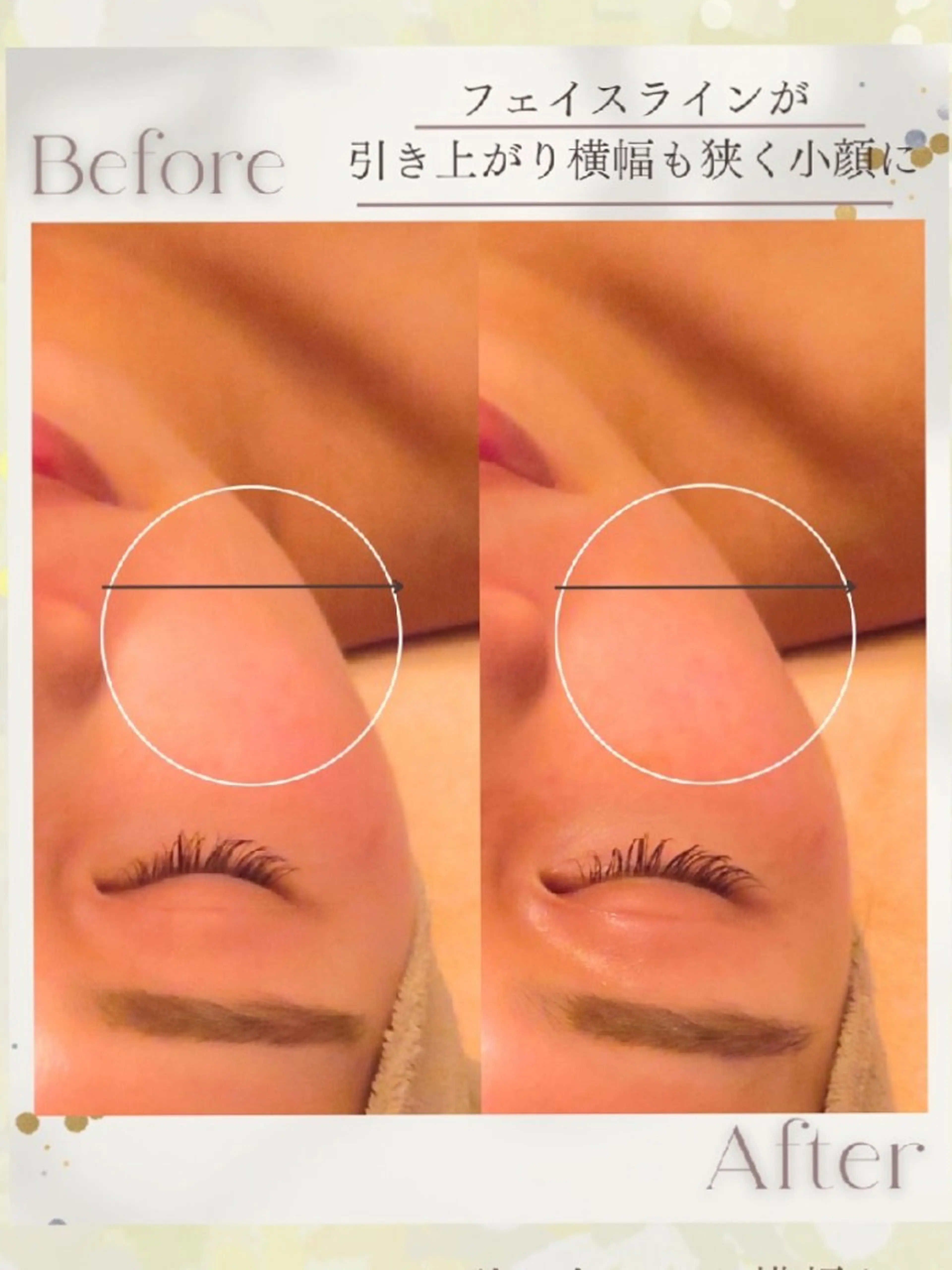 小顔リフトアップ専門 サロン／ダリア 大分のエステ・リラクイメージ