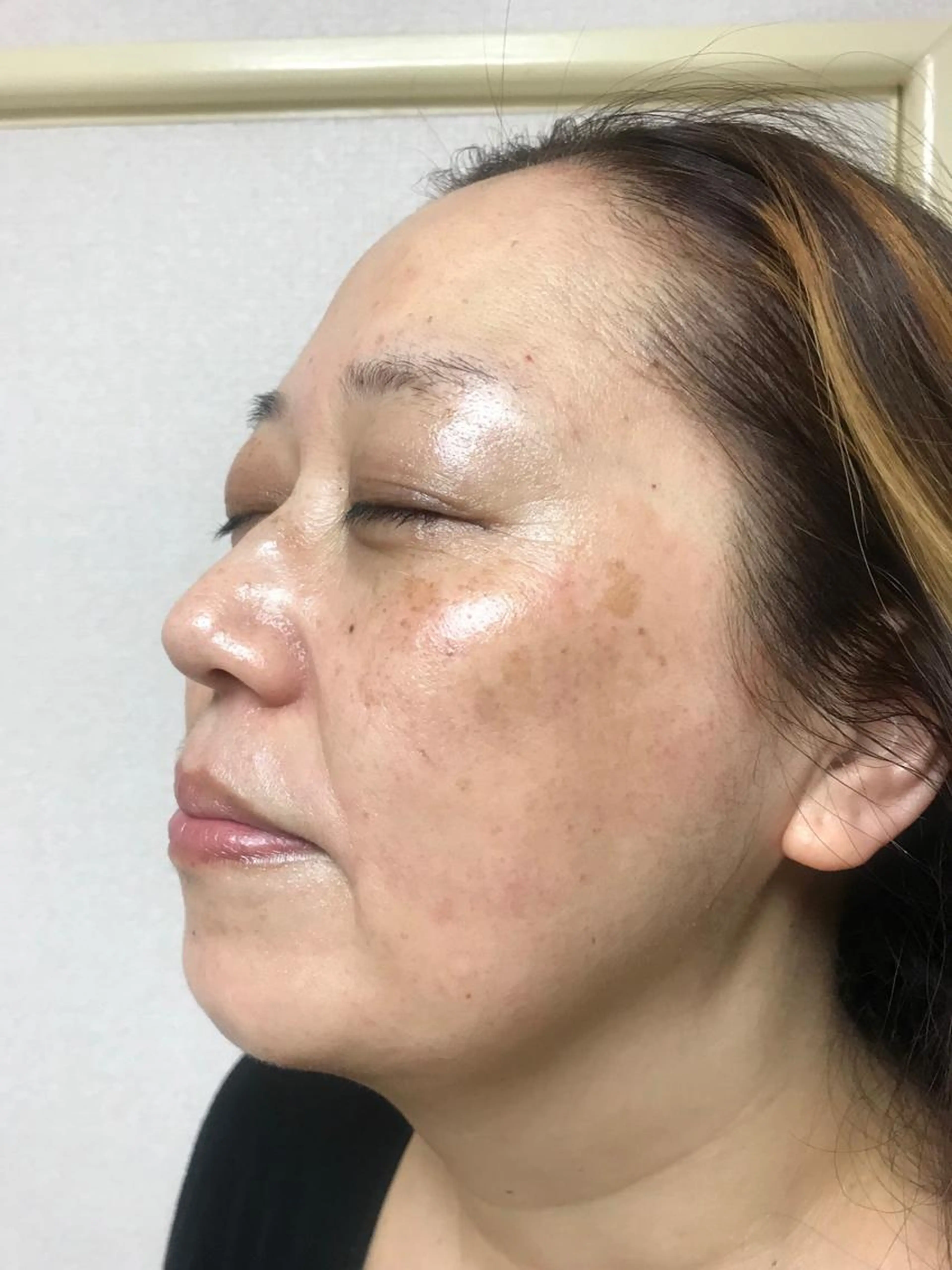 紫外線☀️が弱いからこそ、この季節に。美白ケアは、おすすめです🤗の写真