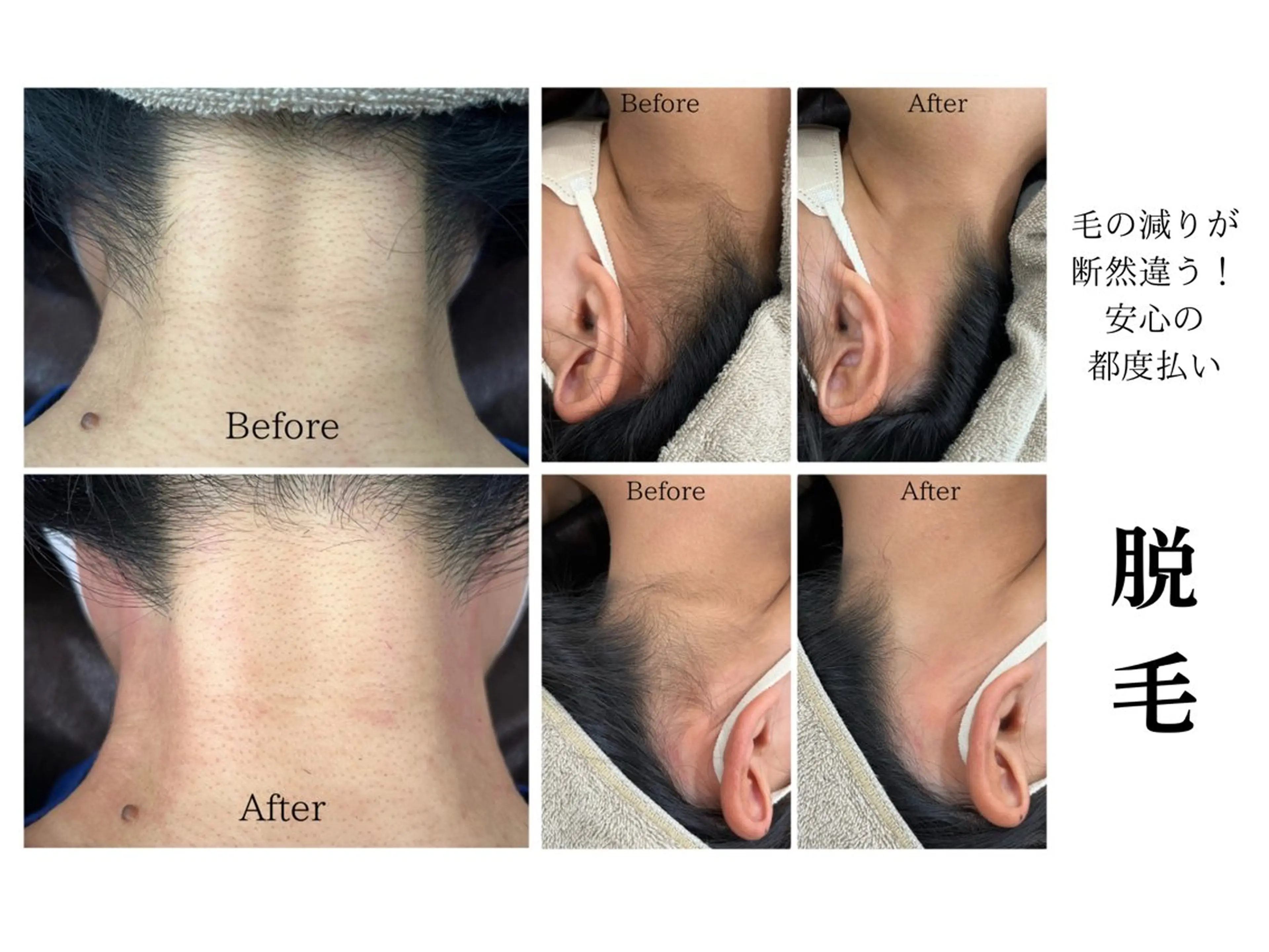 脱毛 LiLL by Andre beauty所属・LiLL 熊本のエステ・リラクイメージ