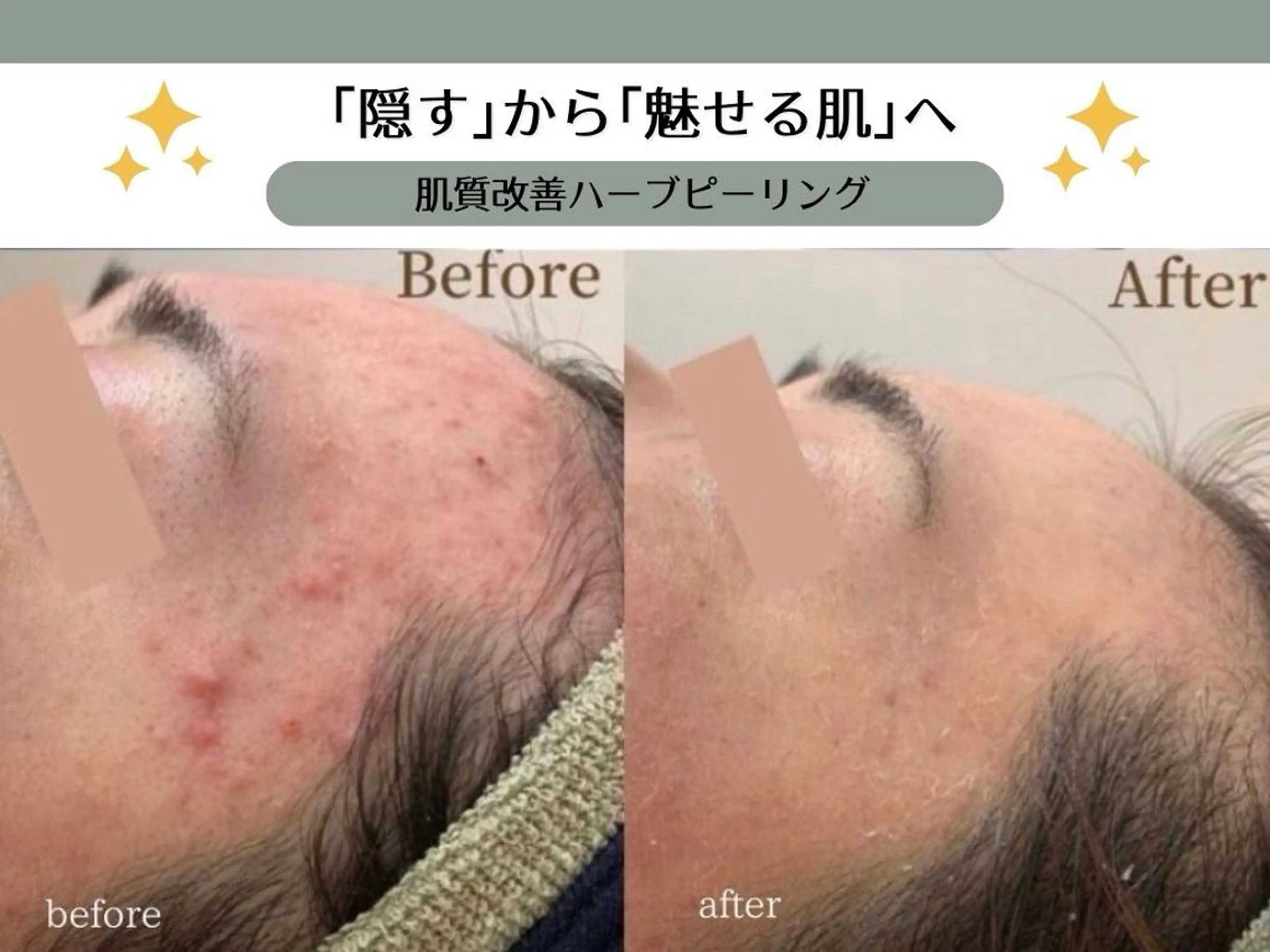 VIKI BEAUTYのエステ・リラクイメージ