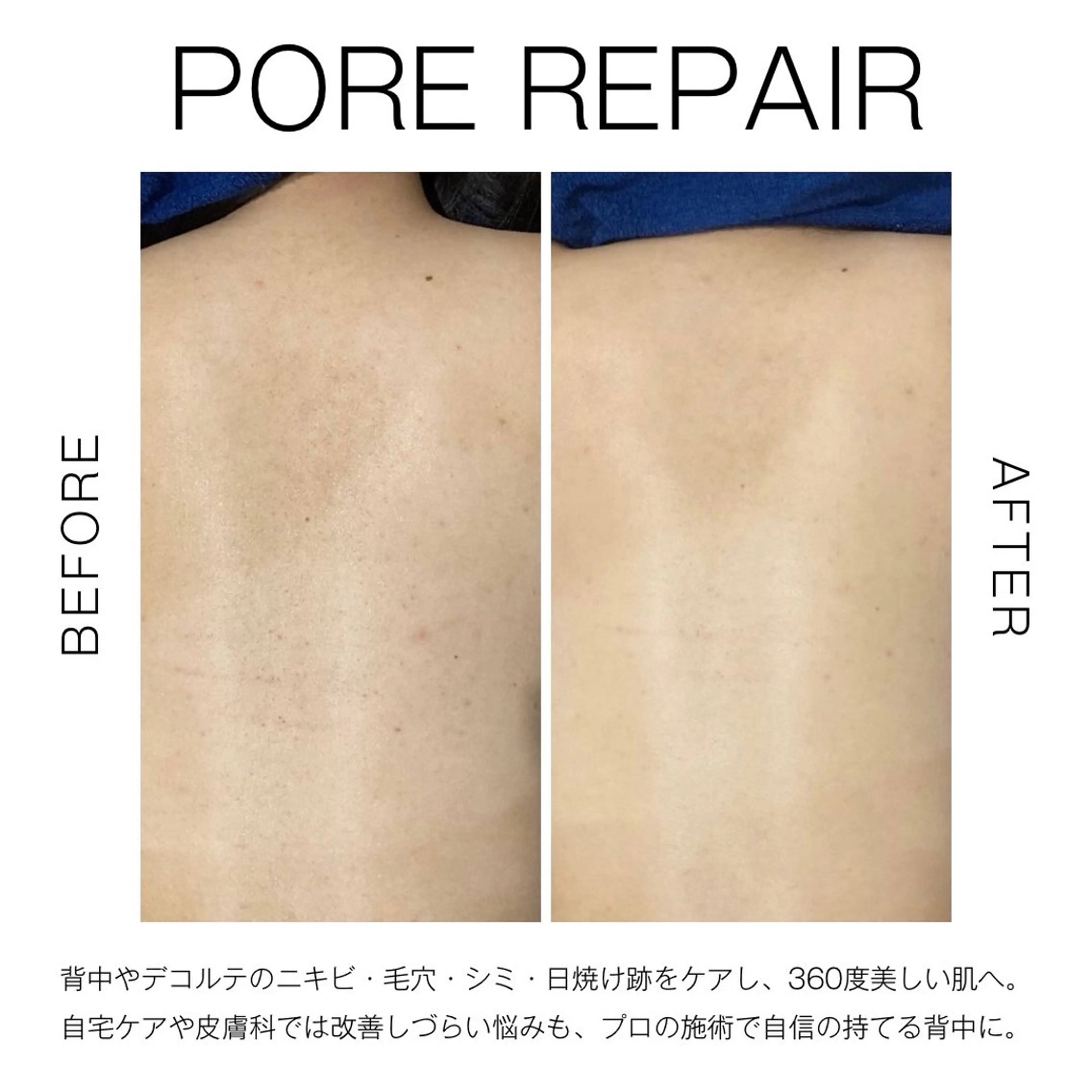 エステ リラク NANIOAFU [なんば店］のその他イメージ