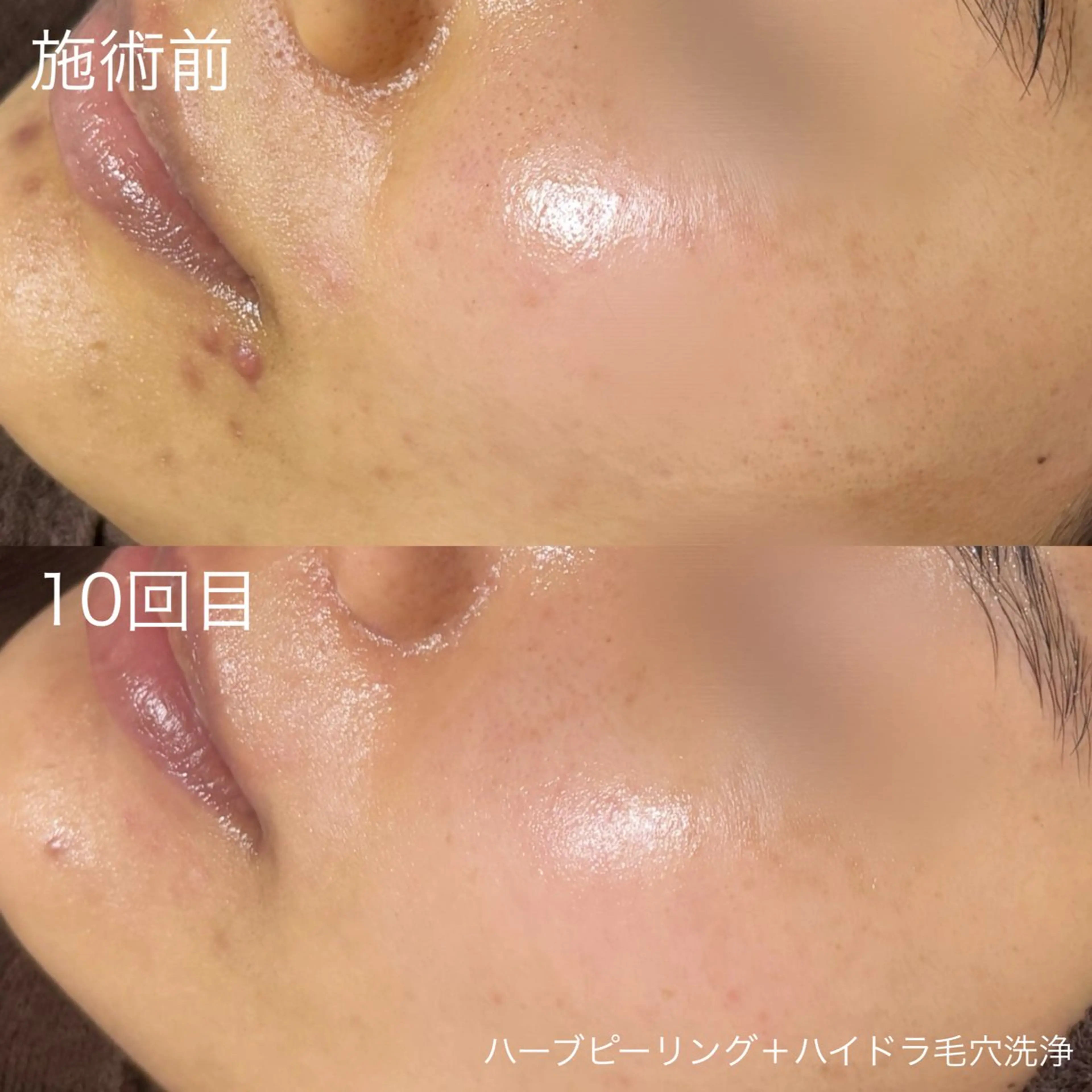 脱毛 lulula ricoのエステ・リラクイメージ